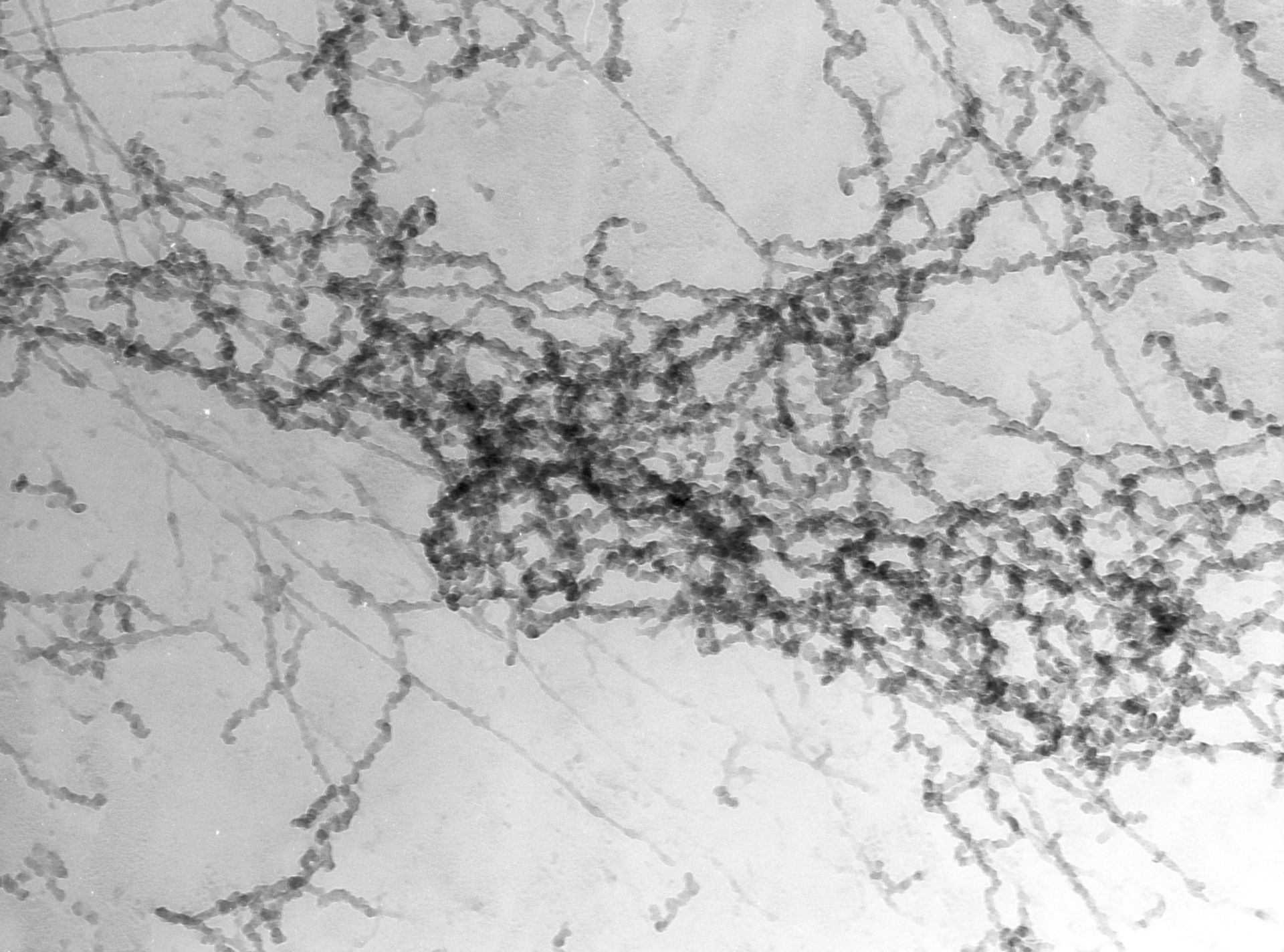 Notopthalmus viridescence (Nuclear chromatin) - CIL:10082