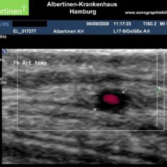Arteriitis DocCheck Flexikon