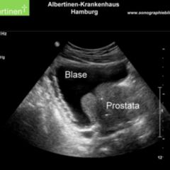 prostata anatomie doccheck