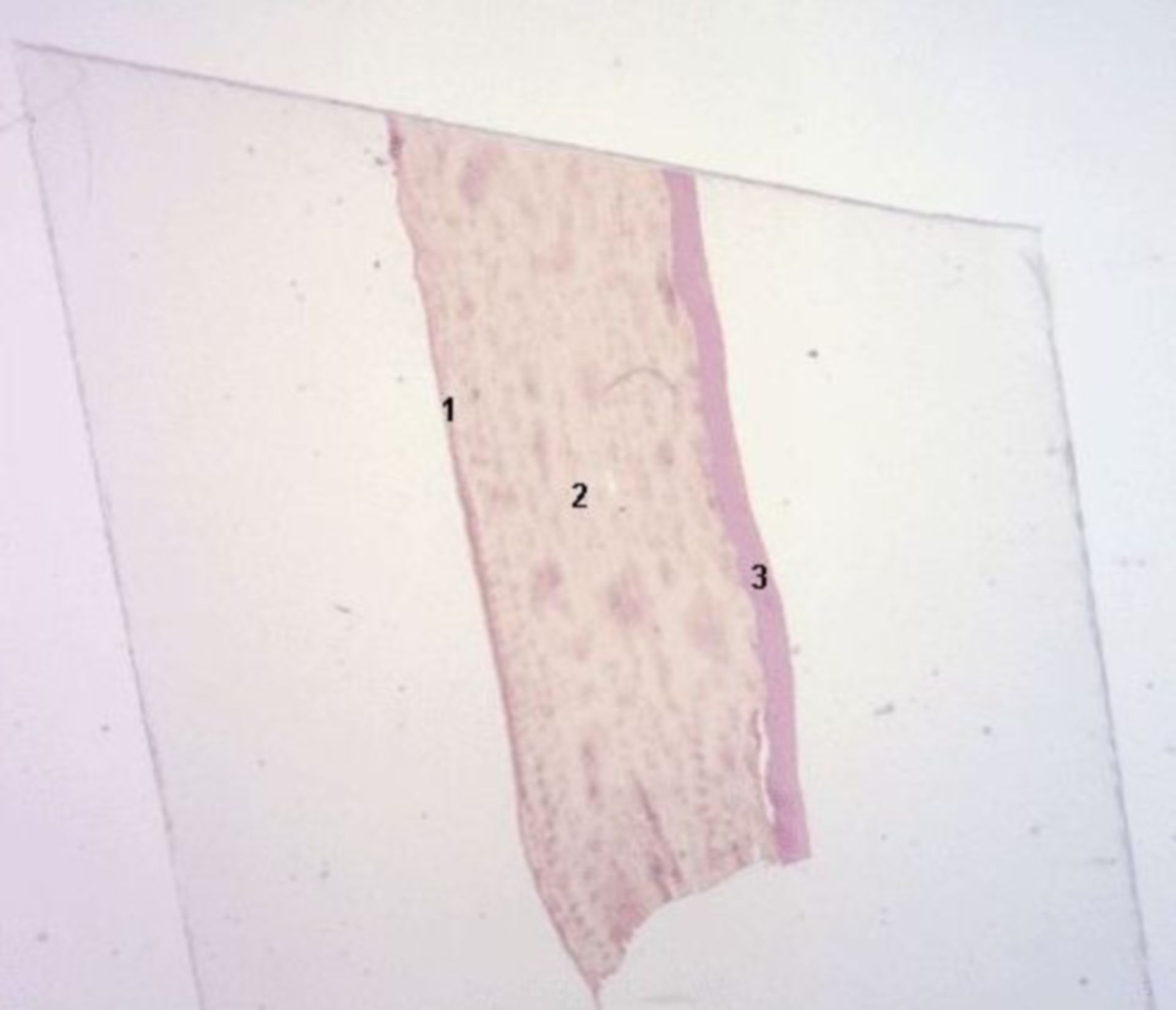 Mikroskopie: Cornea (1,6x)
