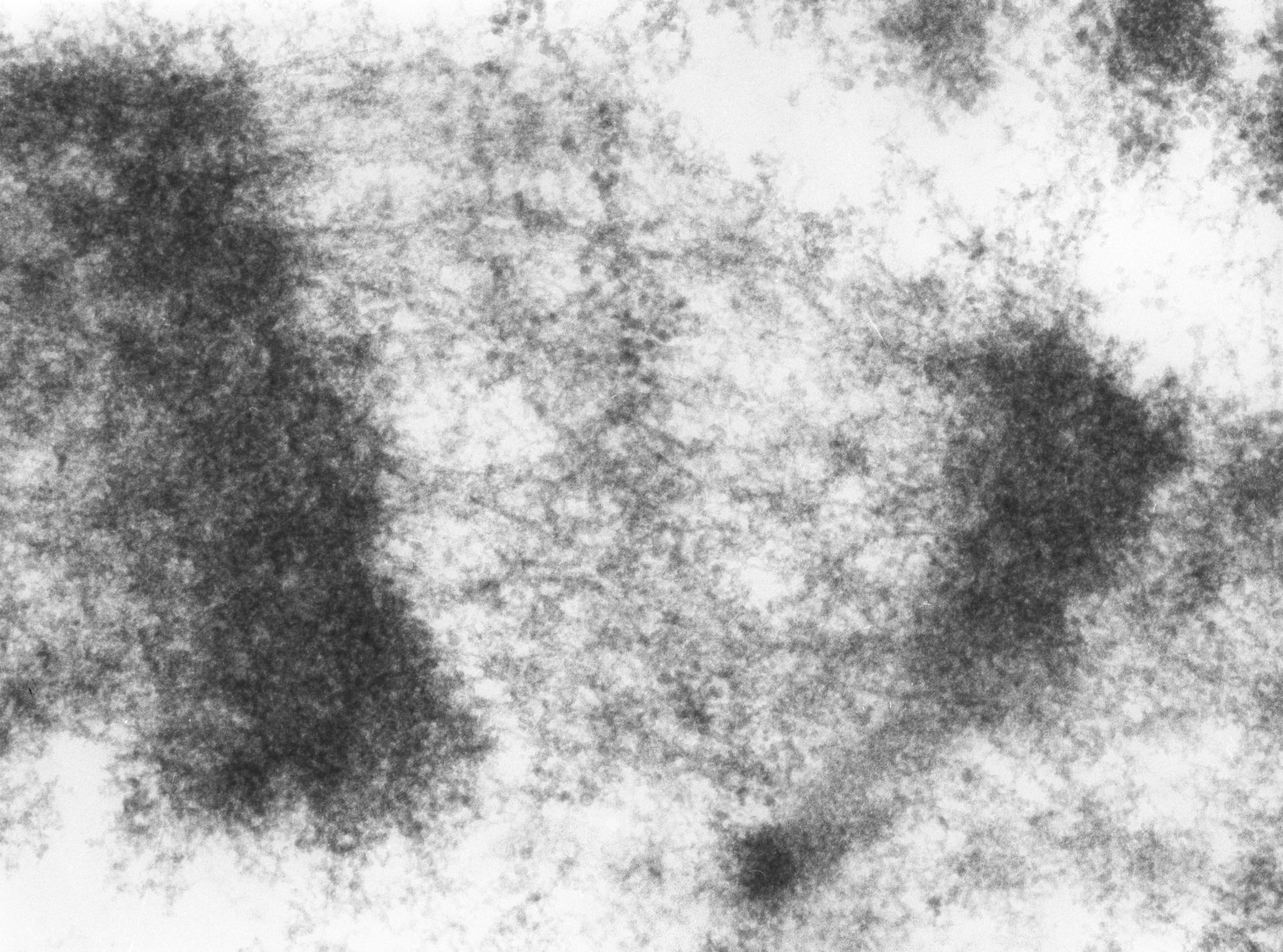 Drosophila melanogaster (Polytene chromosome) - CIL:24967