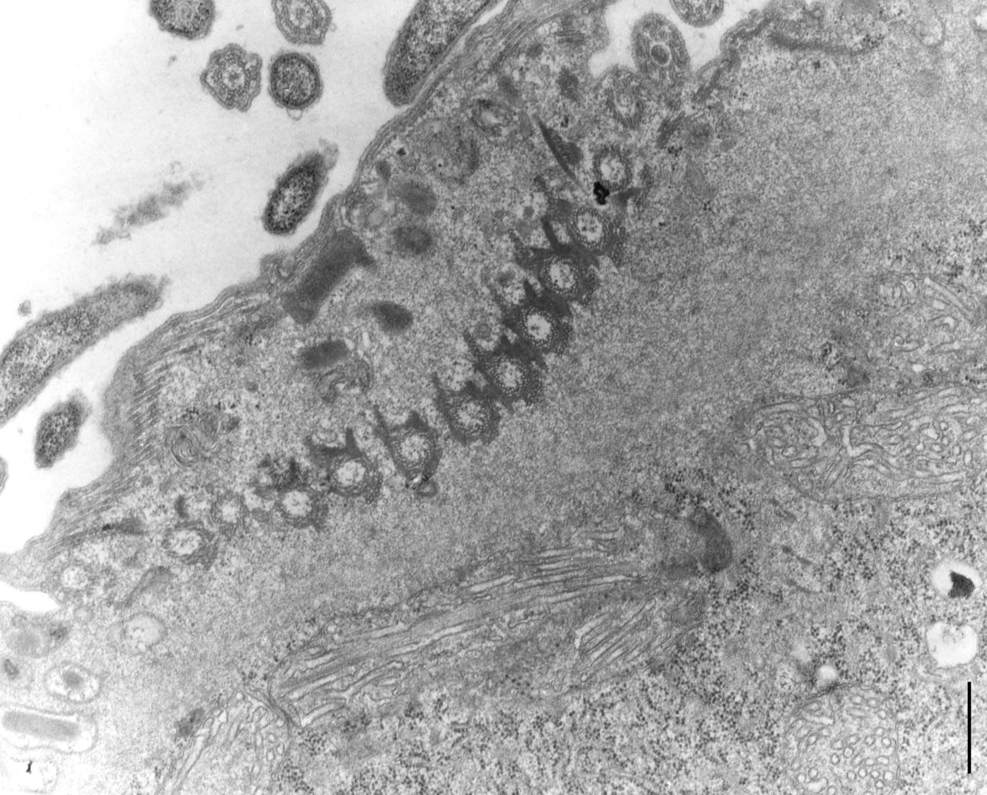 Didinium nasutum (Bacterial ectosymbiont) - CIL:10013