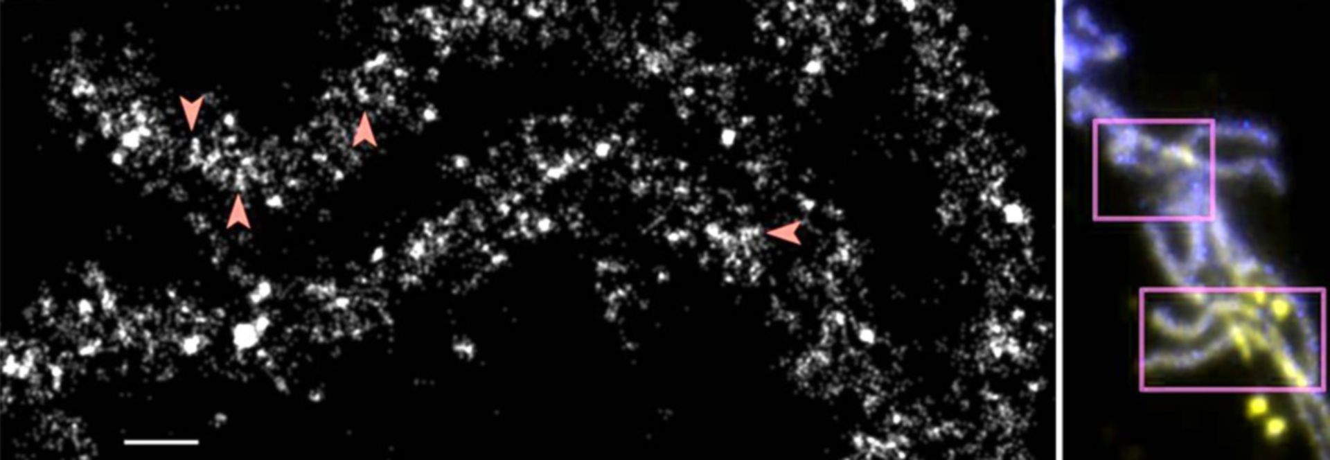 Drosophila melanogaster (Chromatin) - CIL:39747
