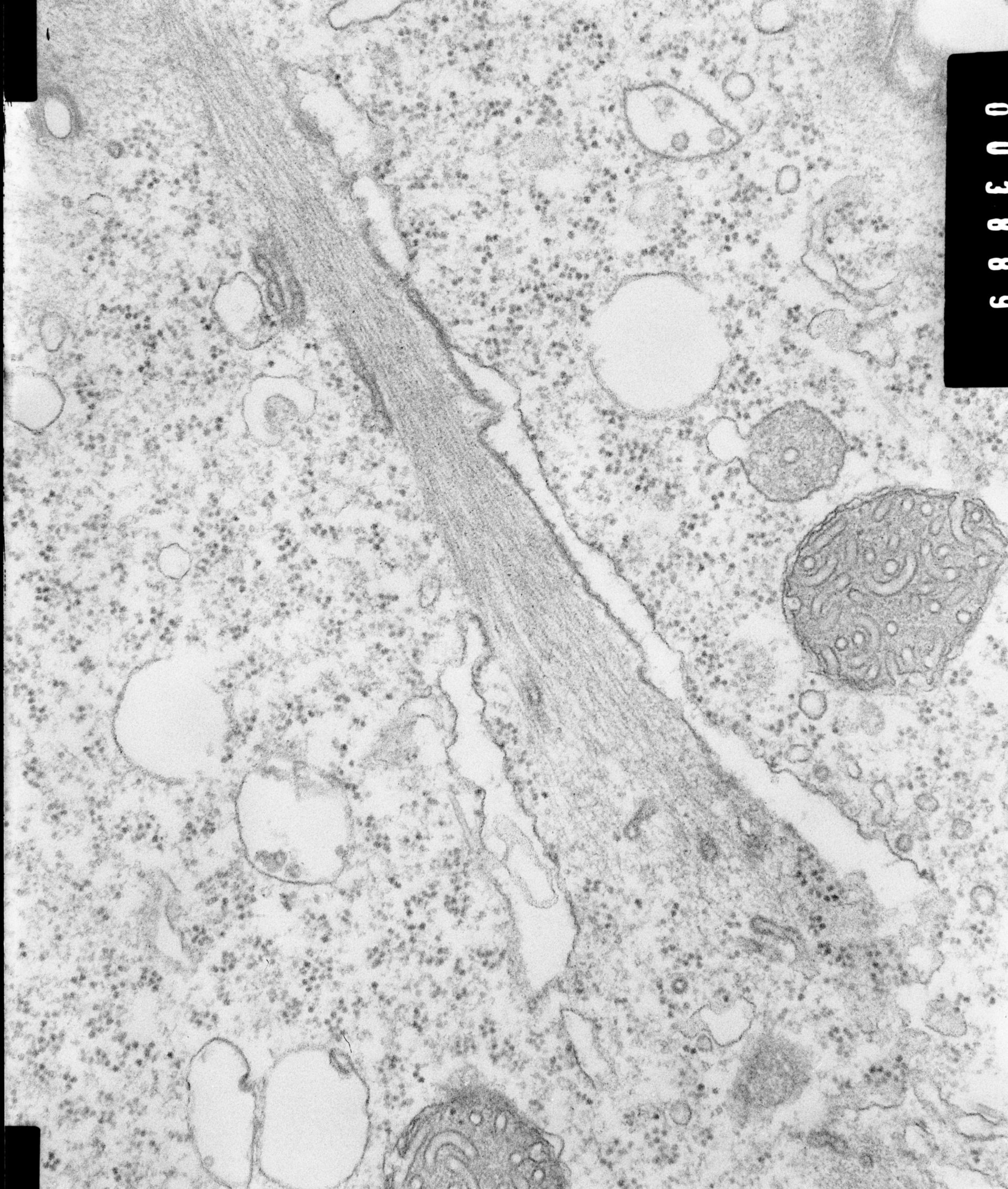 Opercularia coarctata (Mitochondrial inner membrane) - CIL:7342