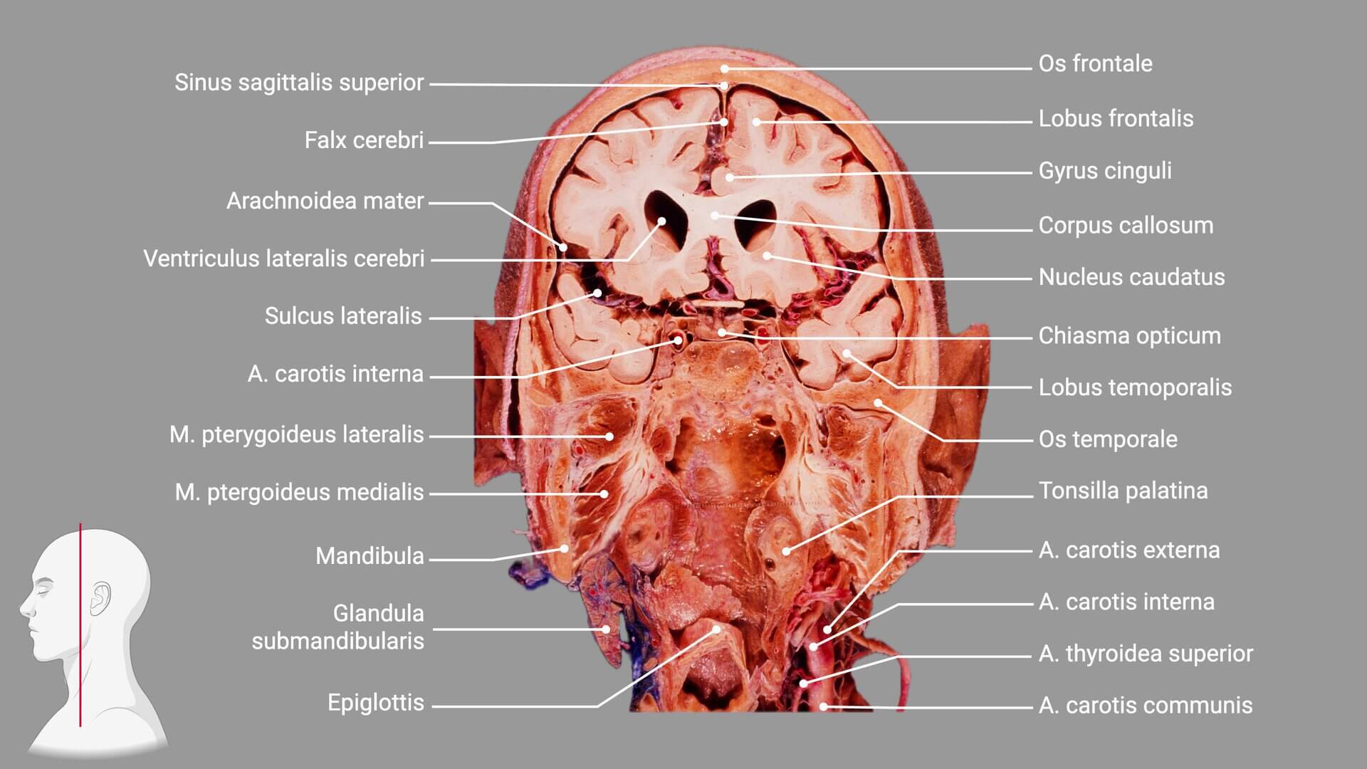 Kopfpräparat mit Beschriftung