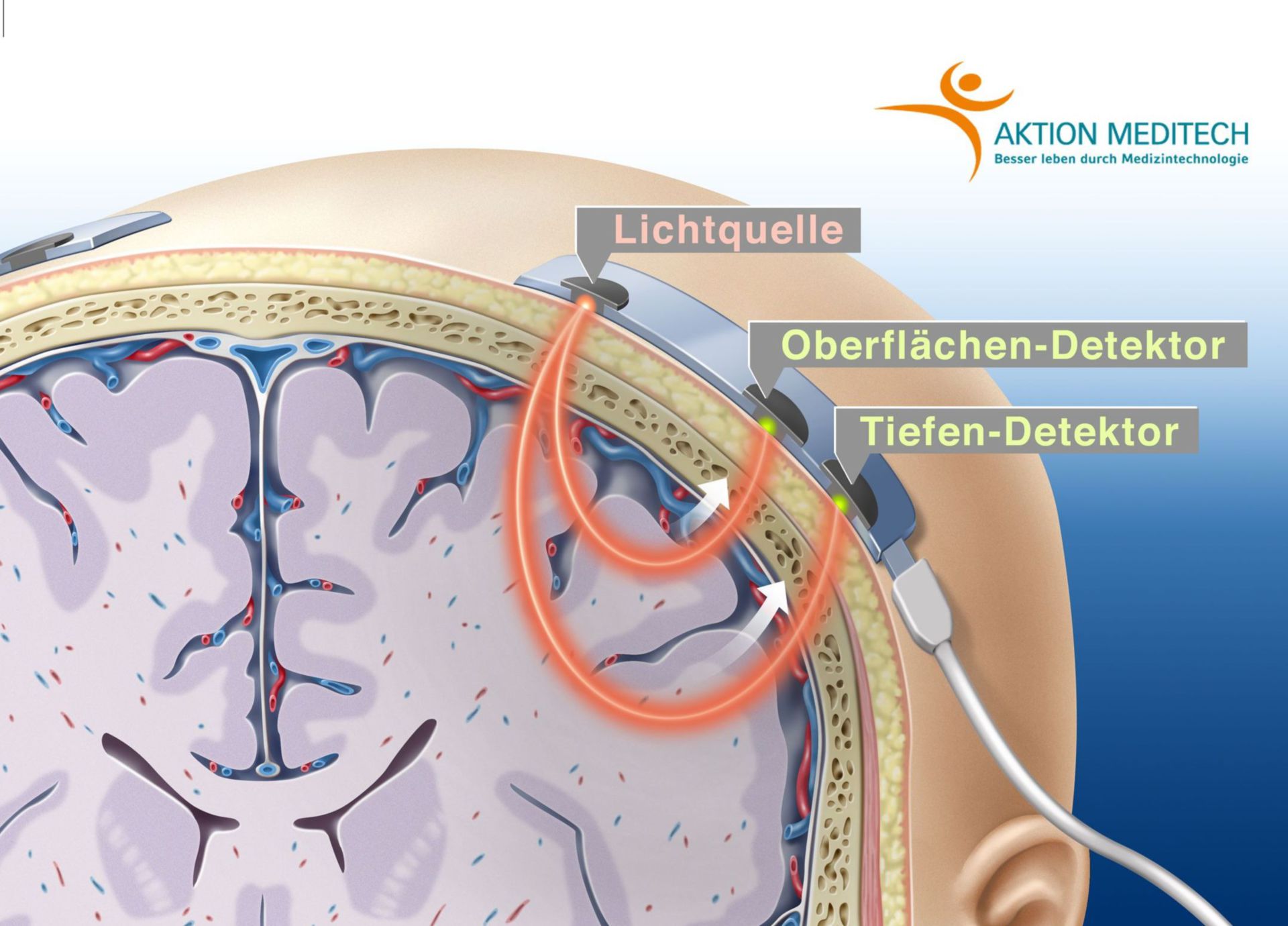 Cerebral oximetry