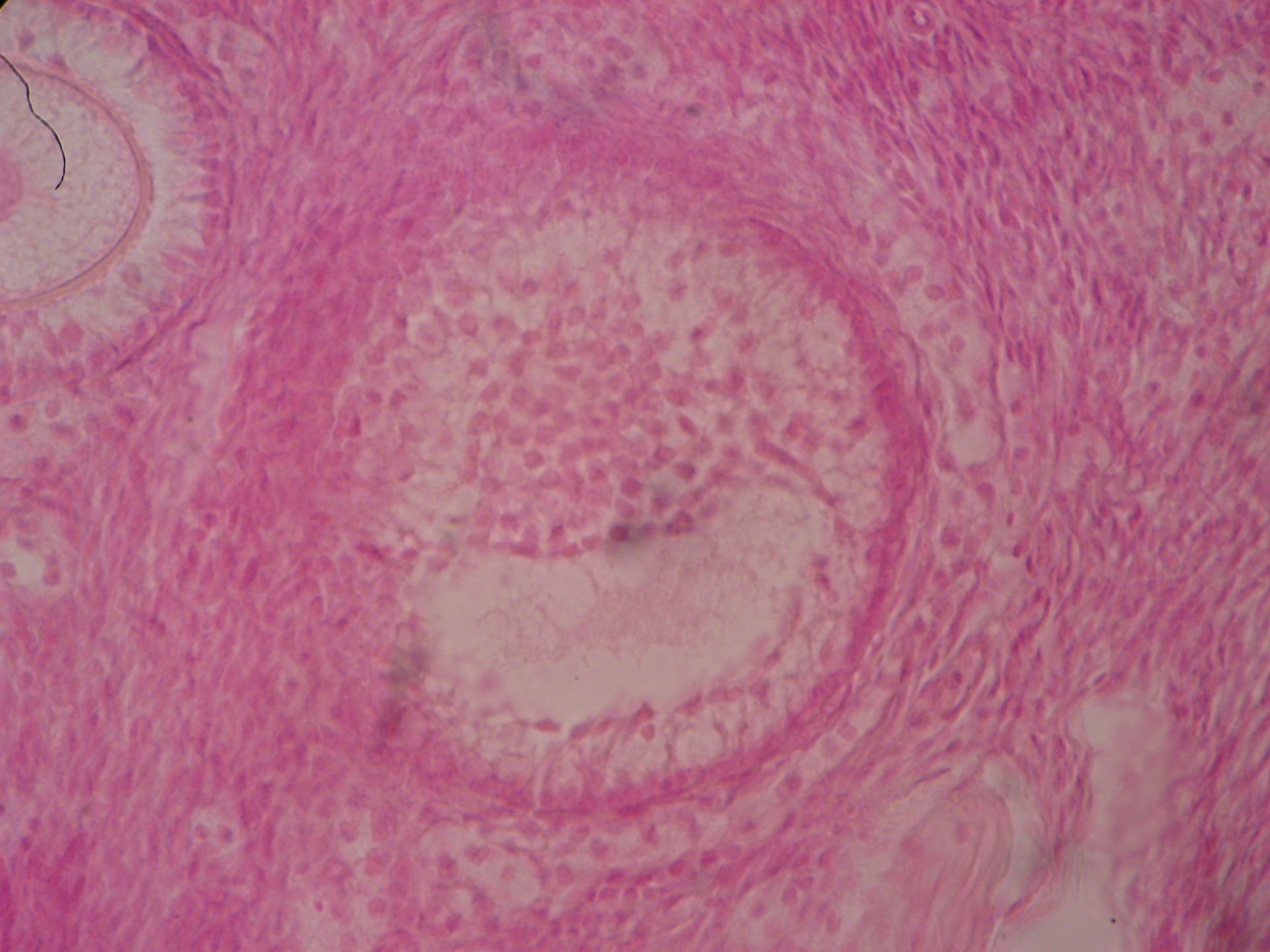 Veterinary Medicine: Ovary of a Cat (11)- Tertiary Follicle