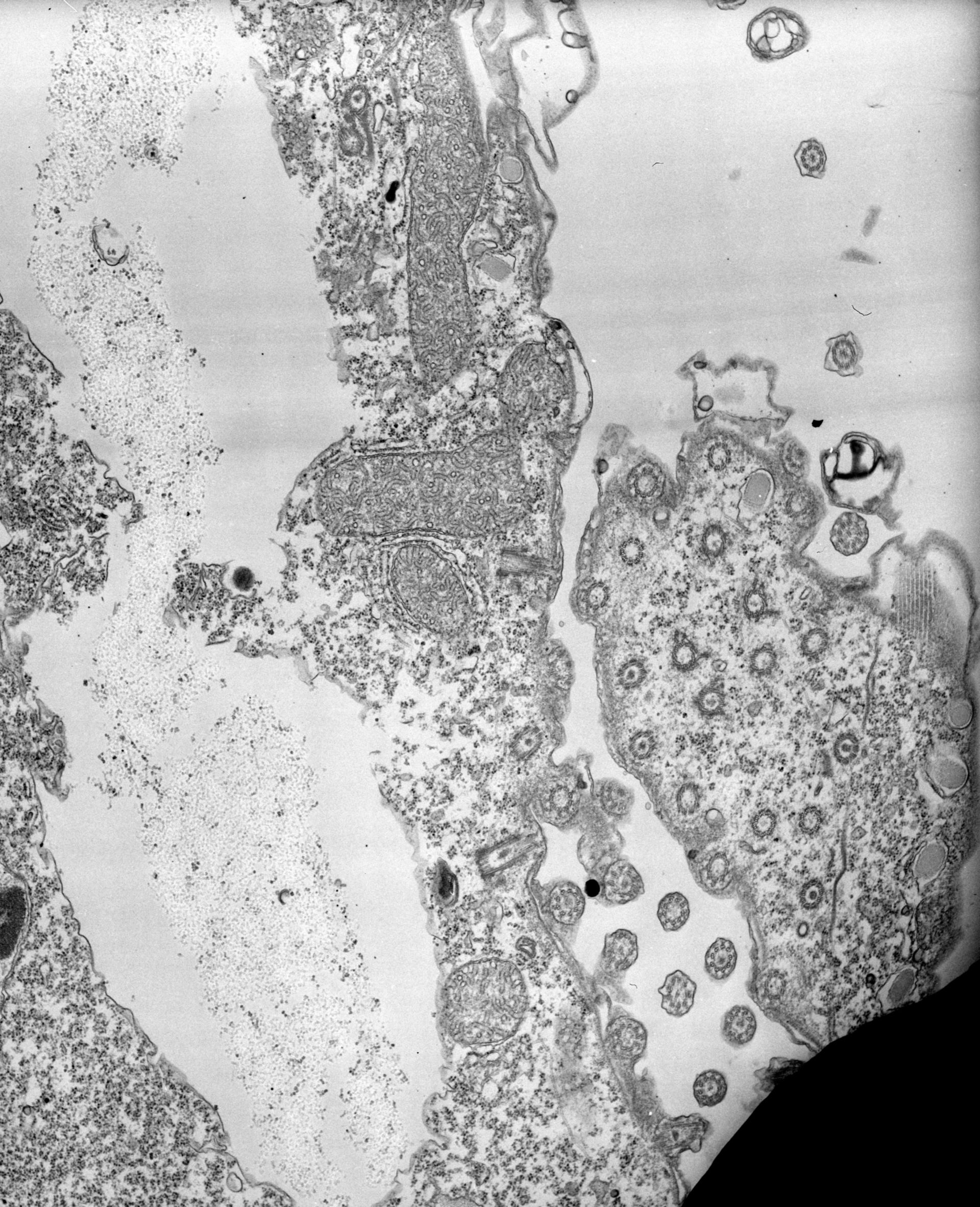 Tetrahymena pyriformis (Cell division site) - CIL:39515