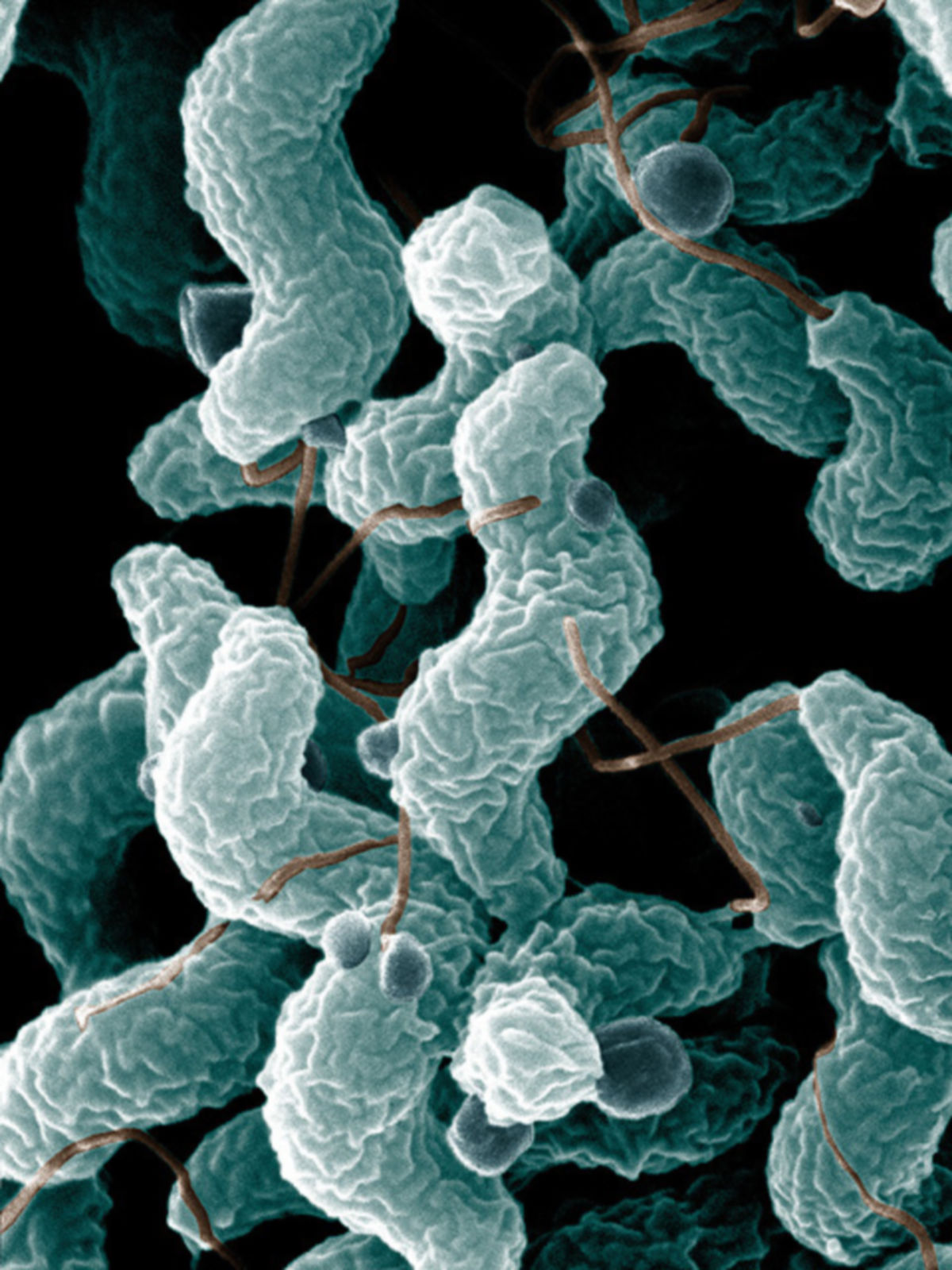 Campylobacter Bakterien (REM, koloriert)
