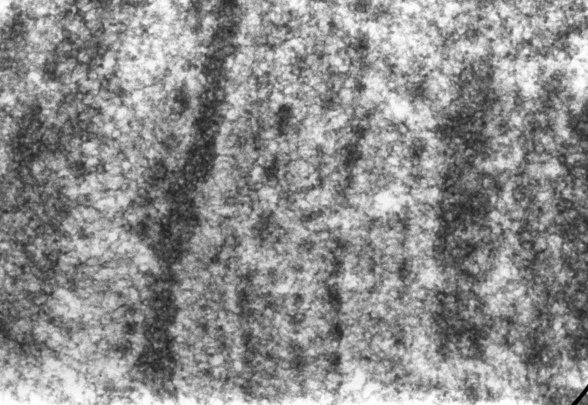 Drosophila melanogaster (Polytene chromosome) - CIL:25323