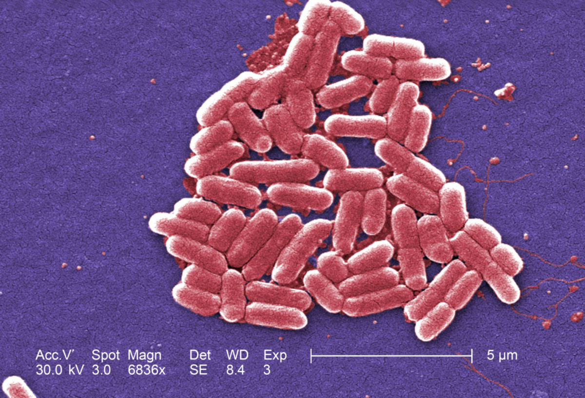 Gram-negative Escherichia coli O157:H7