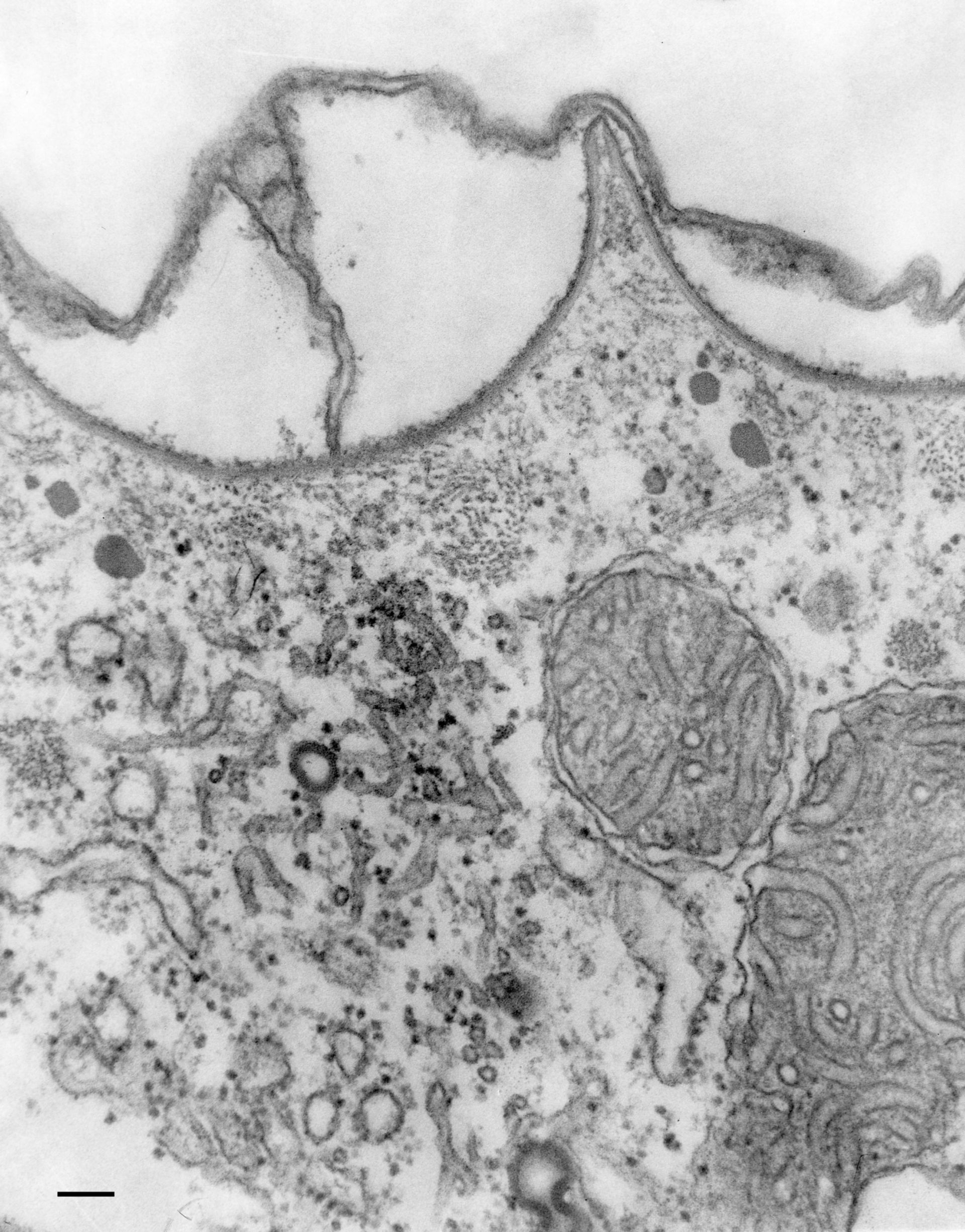 Paramecium multimicronucleatum (Cell cortex) - CIL:36598