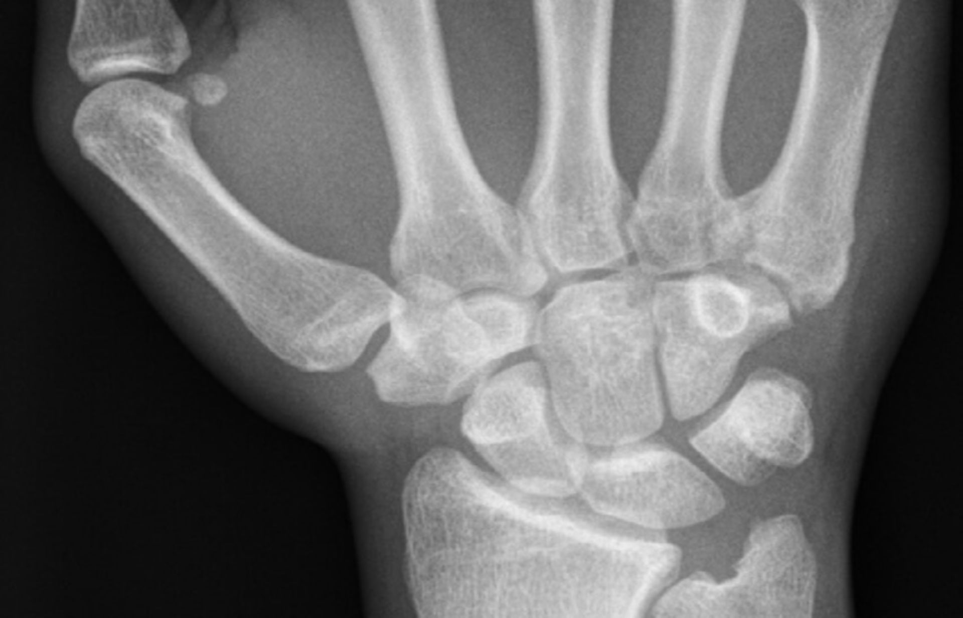 Röntgenaufnahme Hand - DocCheck
