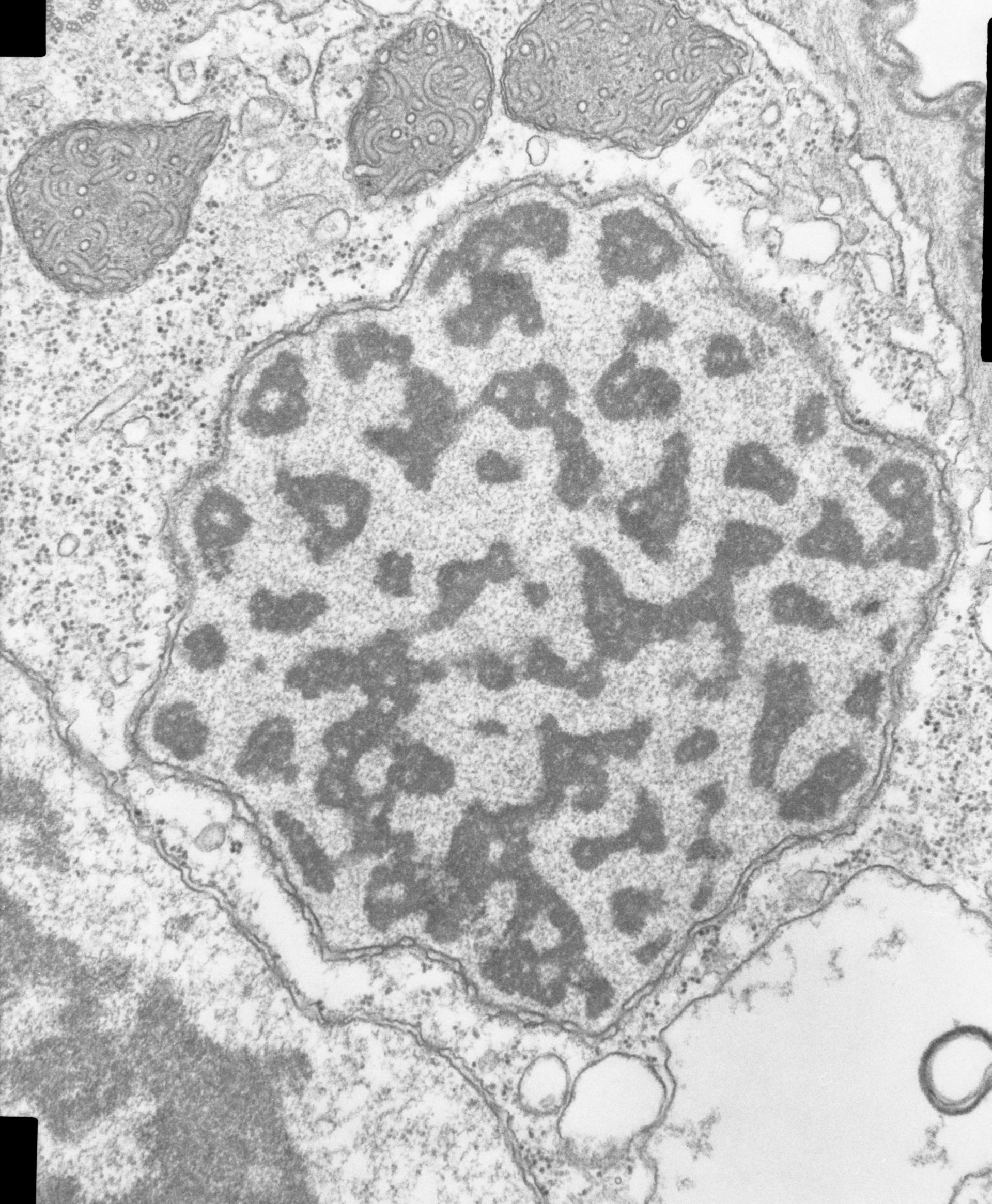 Opercularia coarctata (Nuclear pore) - CIL:7337