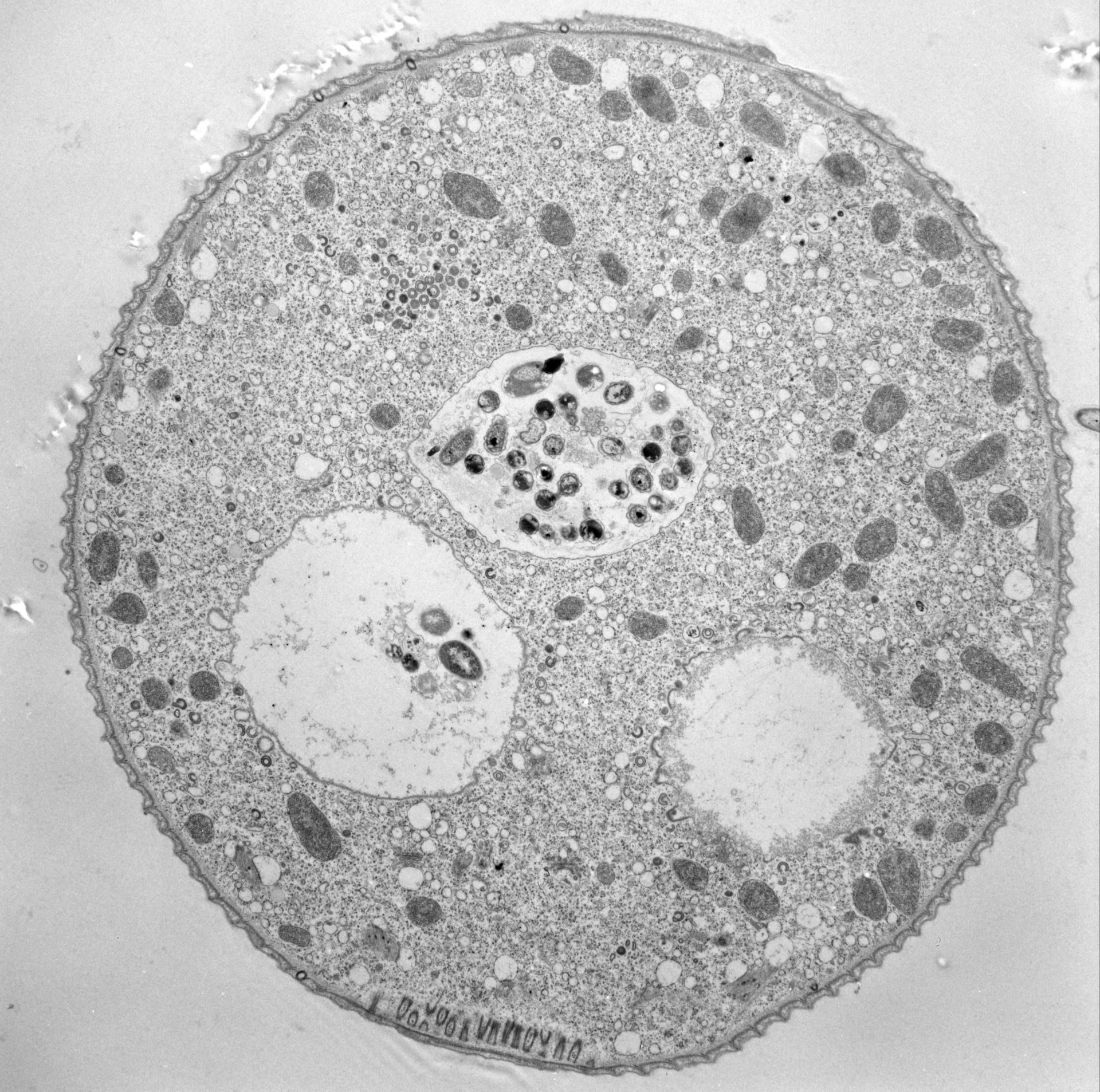 Vorticella convallaria (Food vacuole) - CIL:39327