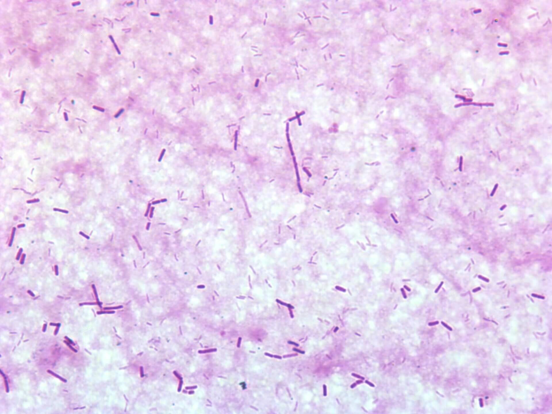 Gasbrand Gramfärbung Clostridium perfringens