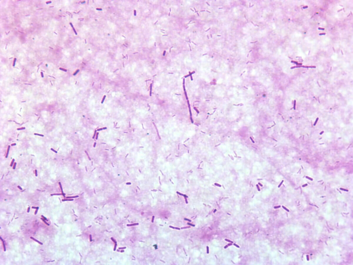 Gasbrand Gramfärbung Clostridium perfringens