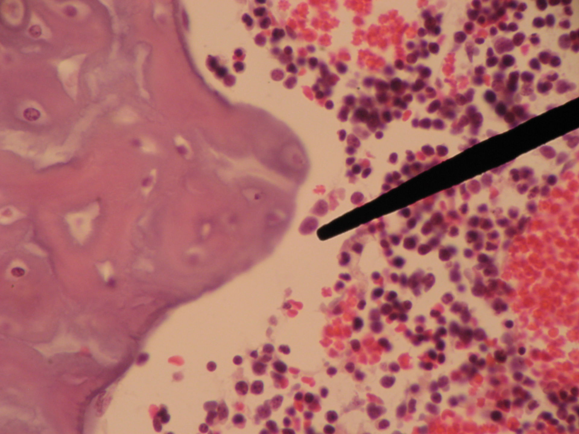 Rotes Knochenmark eines Schweinefetus (3) - Plasmazelle