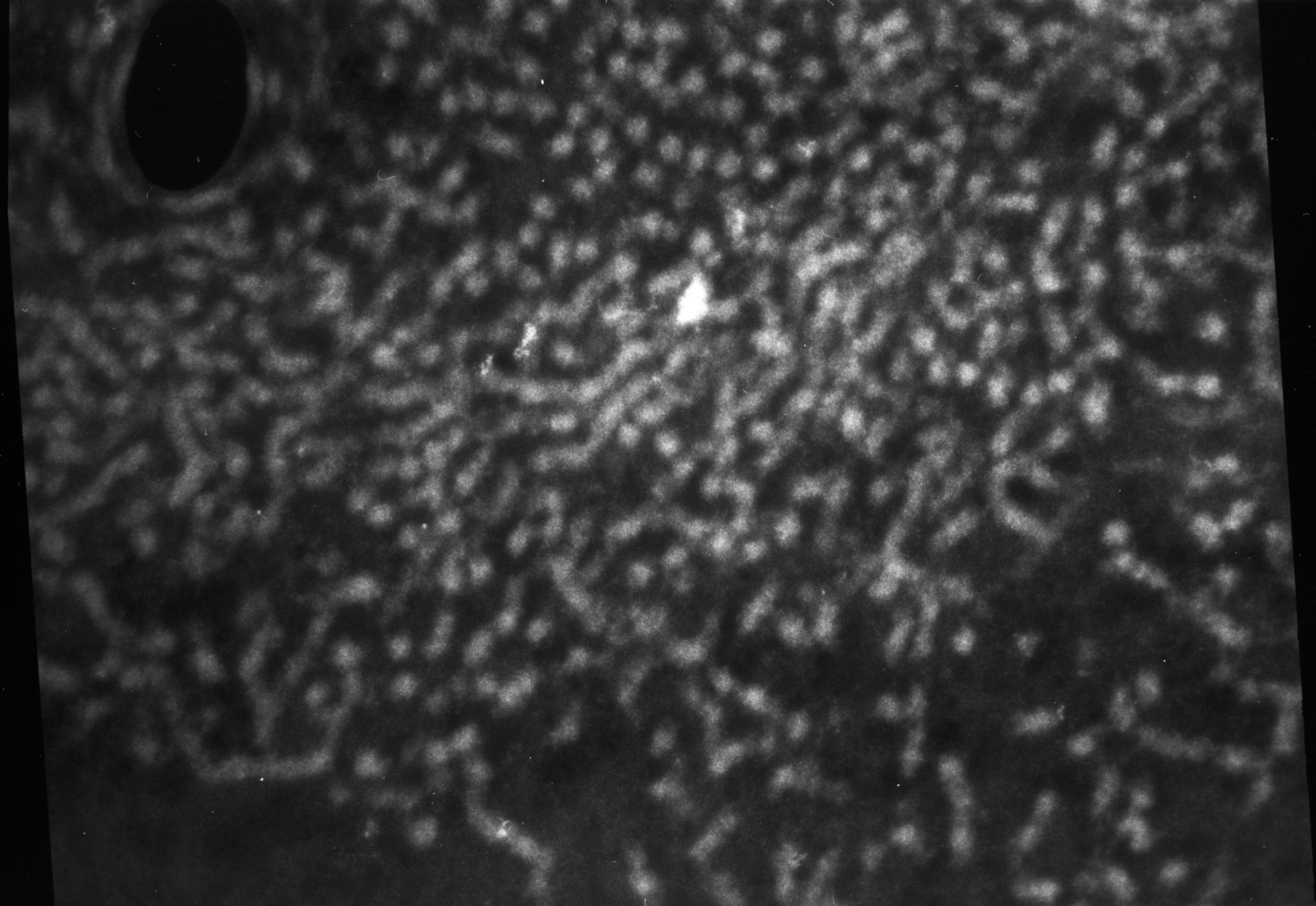 Patiria miniata (Nuclear chromatin) - CIL:766