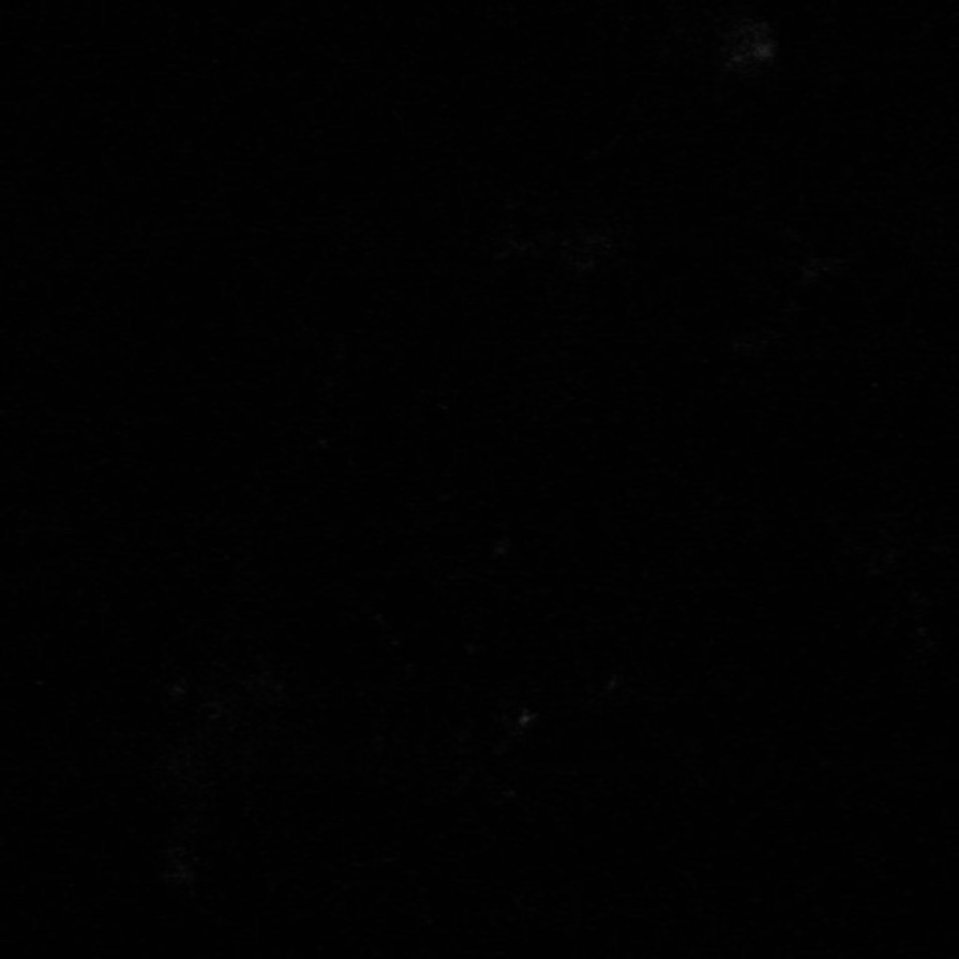 Xenopus laevis (Neuronal cell body) - CIL:37031