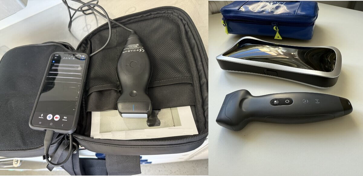 Tragbare mobile Ultraschallgeräte