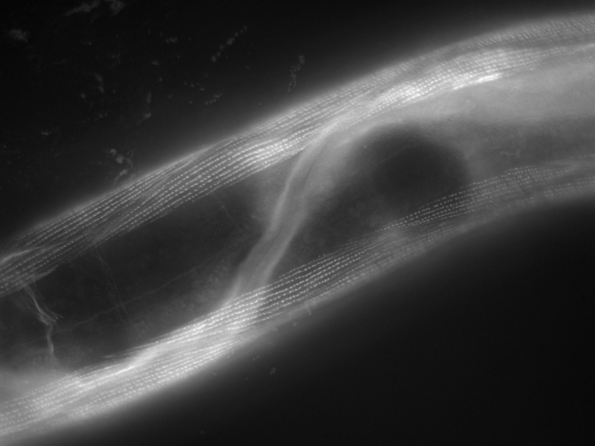 Caenorhabditis elegans (Actin filament) - CIL:1159