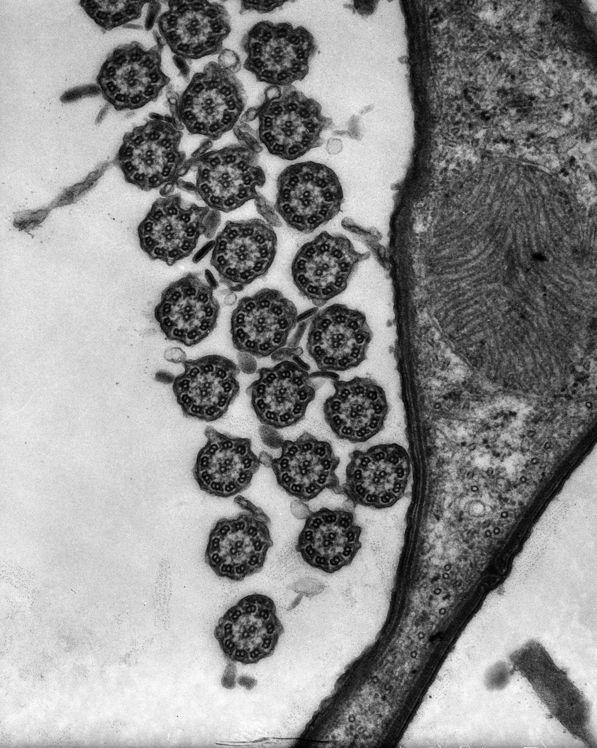 Euplotes sp. (Alveolar membranes) - CIL:9705
