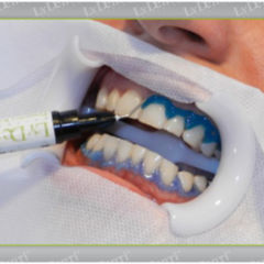 Humanes Herpesvirus 8 DocCheck Flexikon