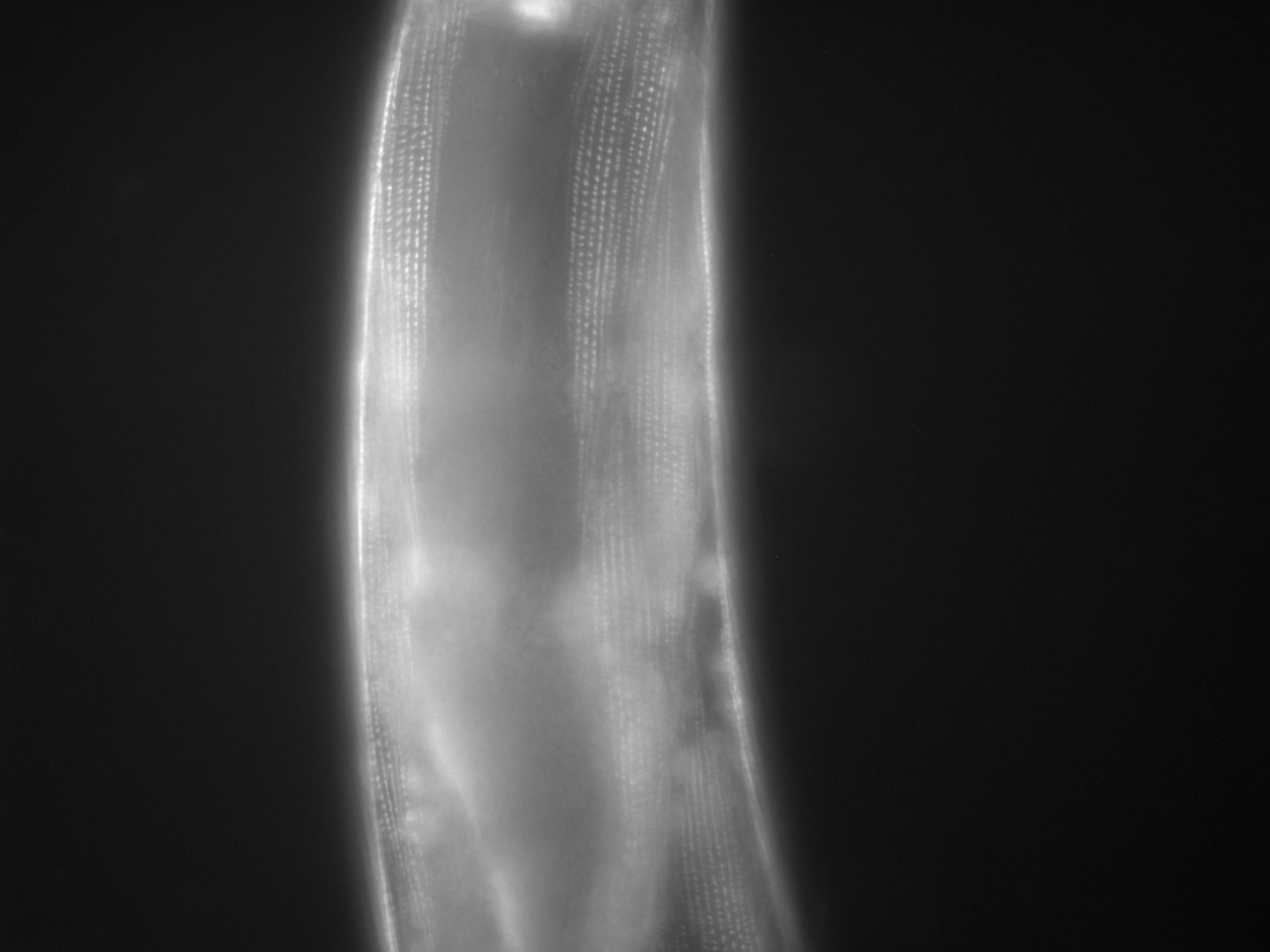 Caenorhabditis elegans (Actin filament) - CIL:1128