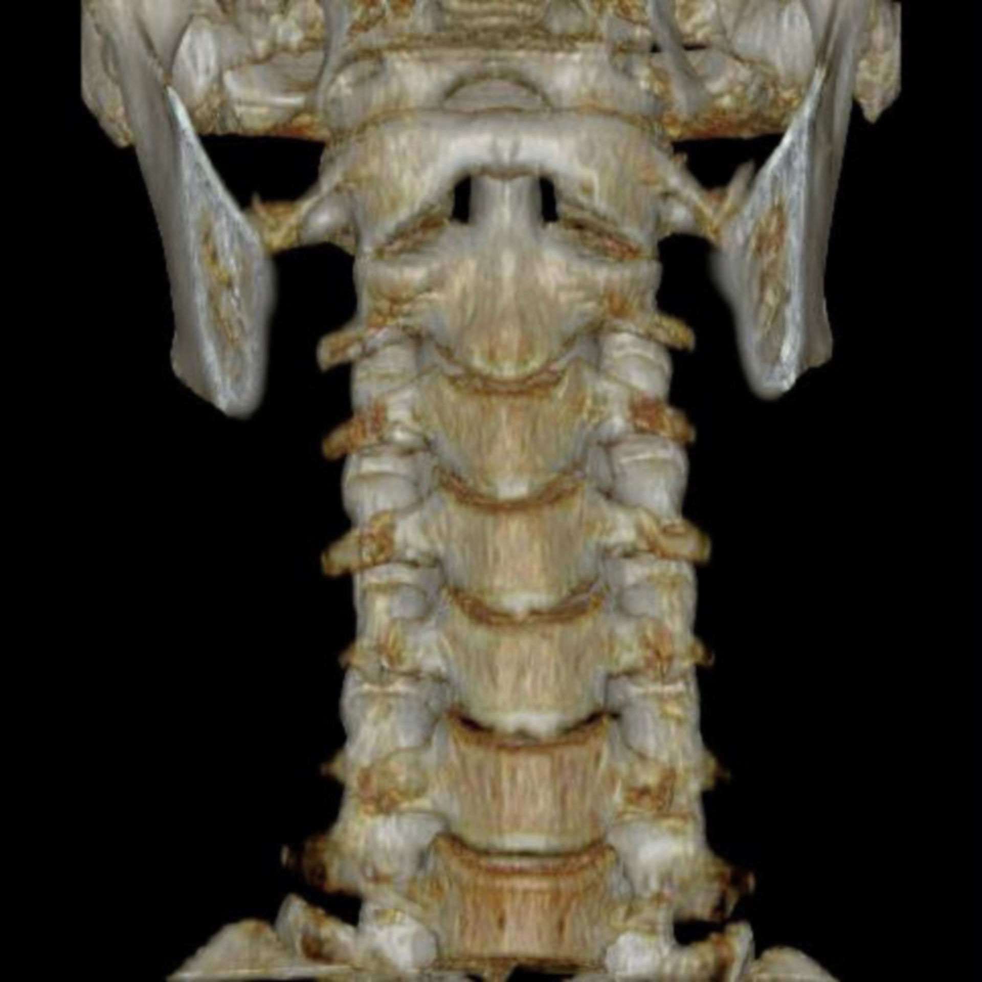 3D representation of the cervical spine
