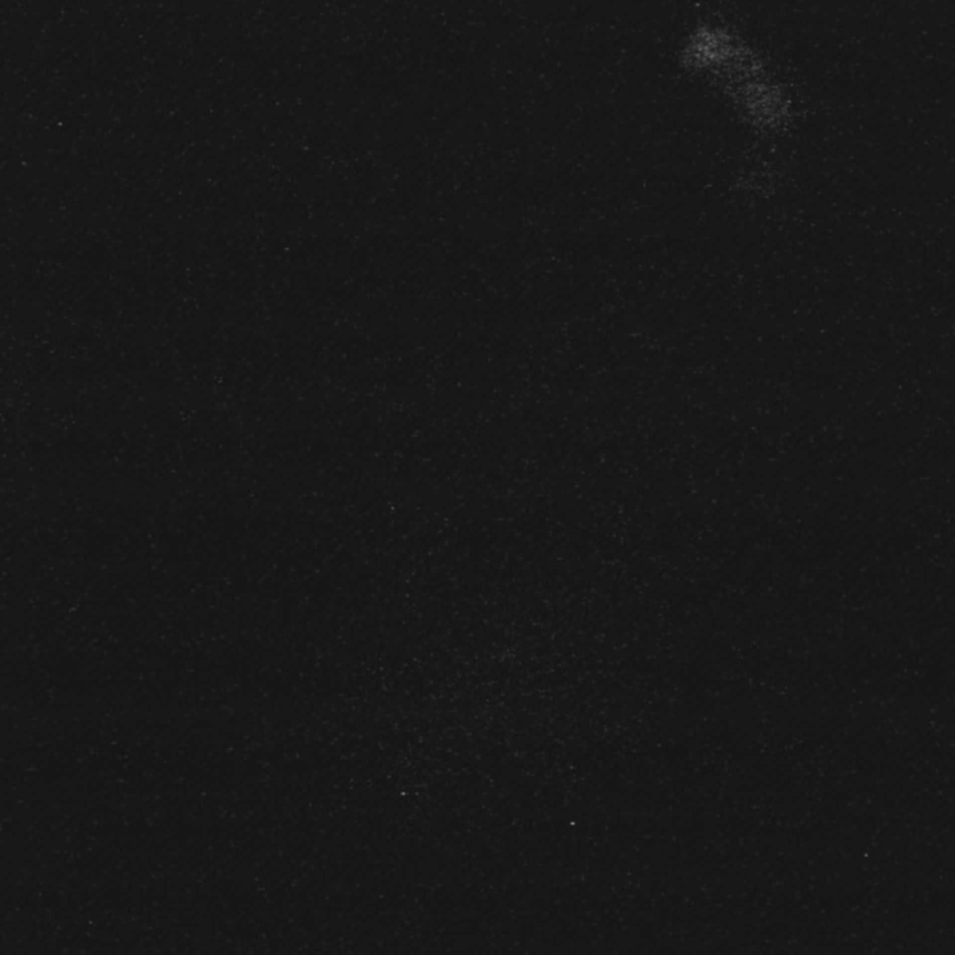Xenopus laevis (Axon) - CIL:36963