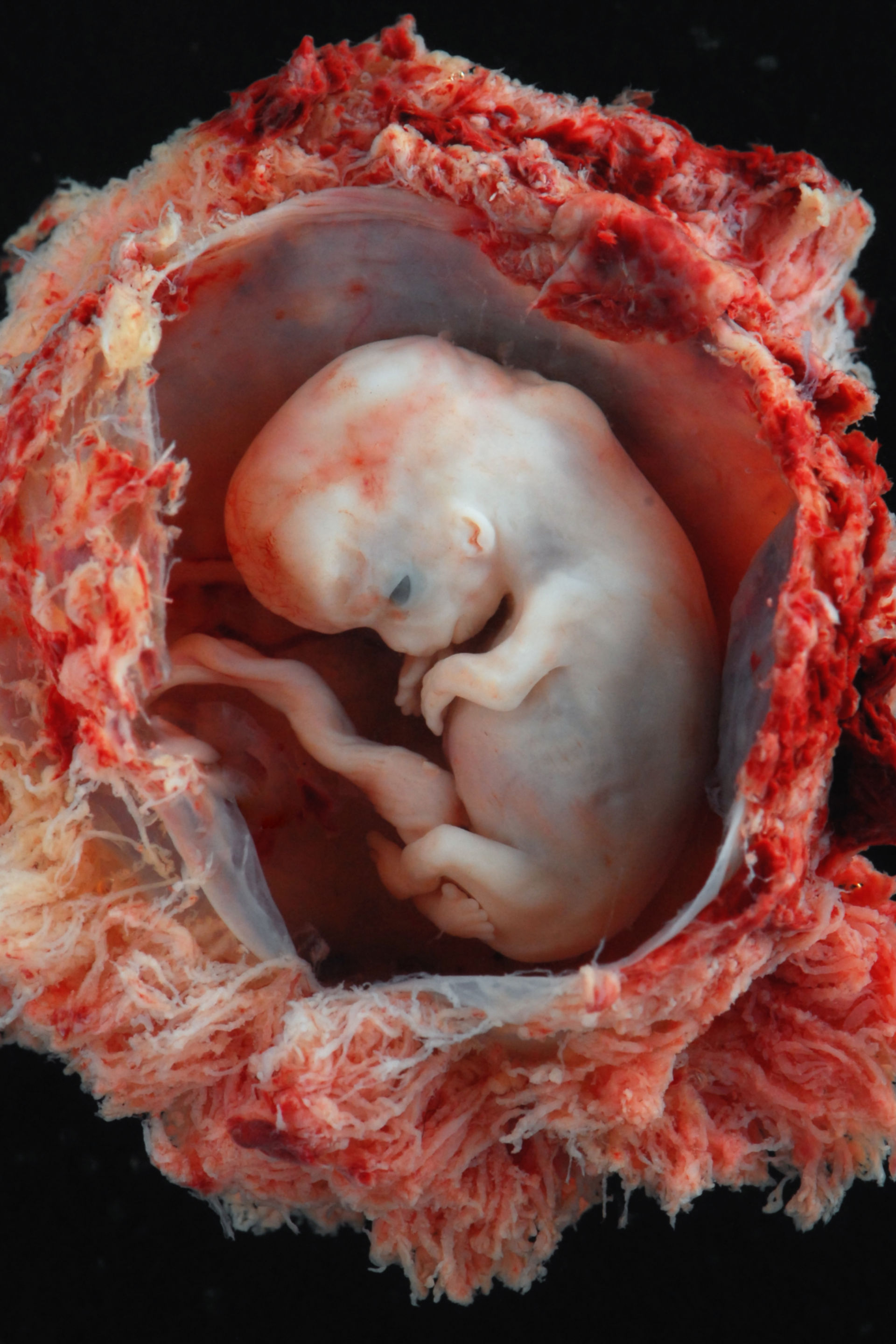 Embryo (8 Wochen nach Empfängnis, Präparat)