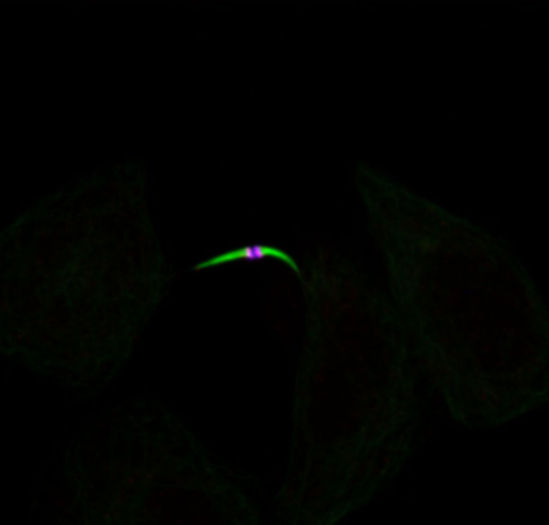 Homo sapiens (Midbody) - CIL:7242