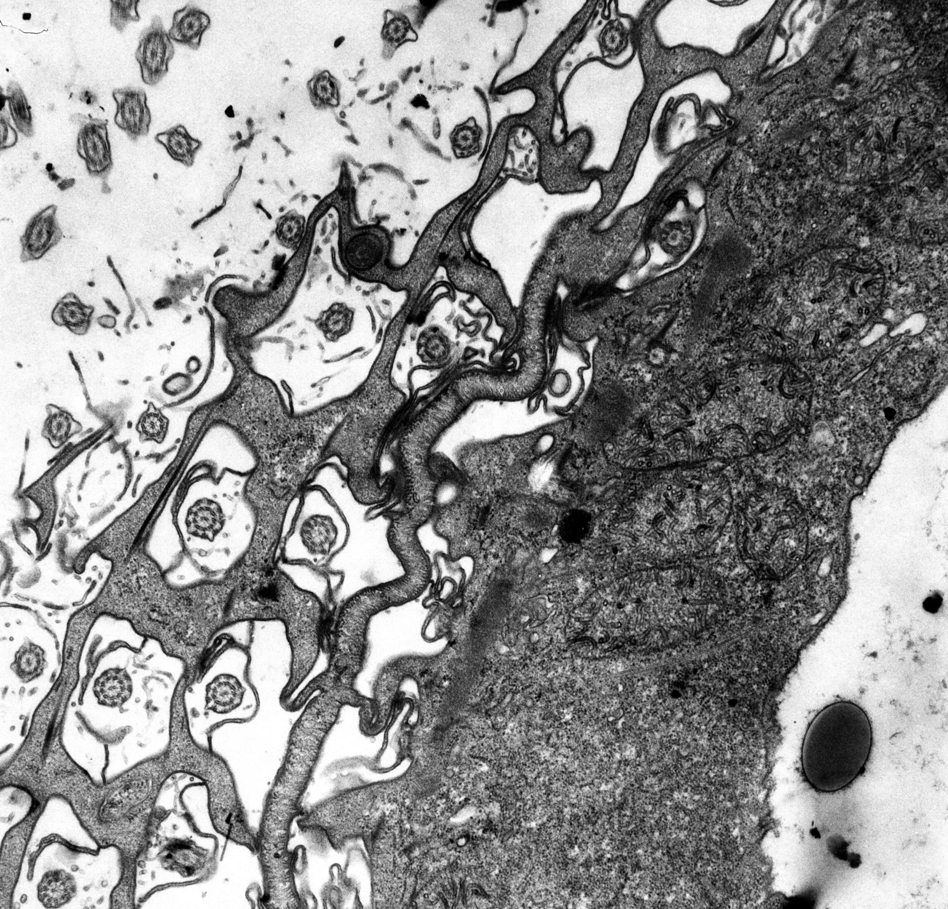 Paramecium multimicronucleatum (Cytoplasm) - CIL:12343