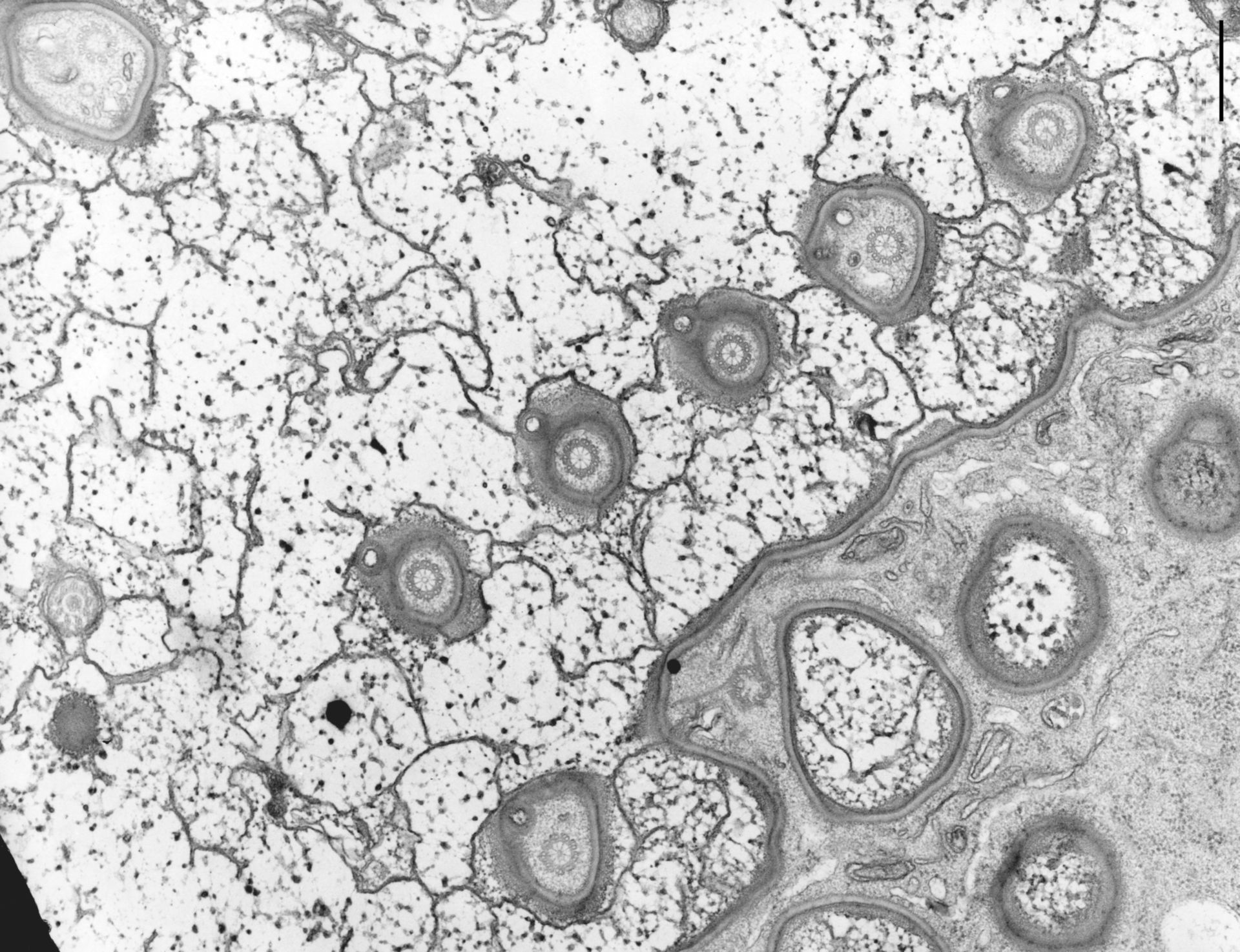 Nassula (Absence of cilia) - CIL:9832