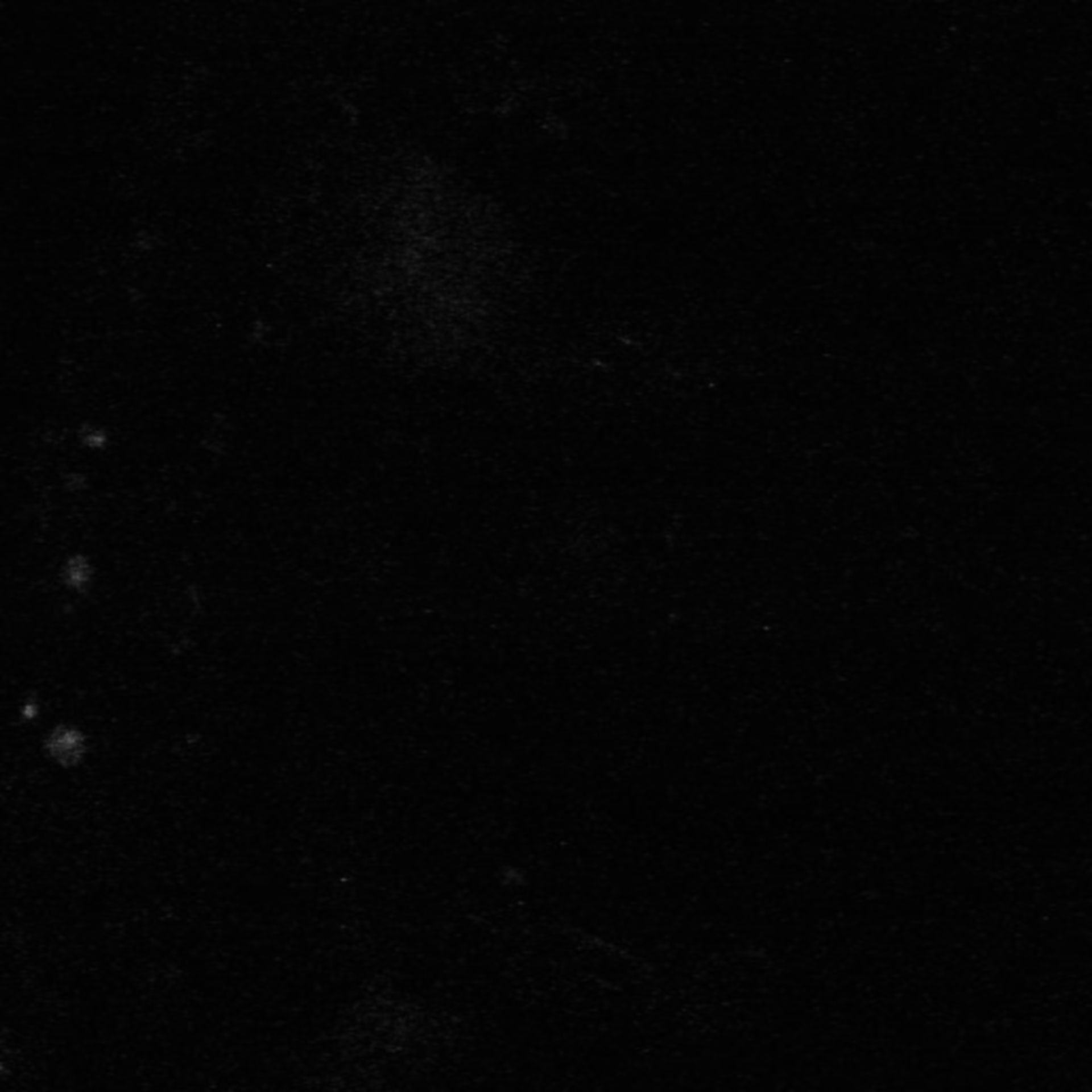Xenopus laevis (Neuronal cell body) - CIL:37041
