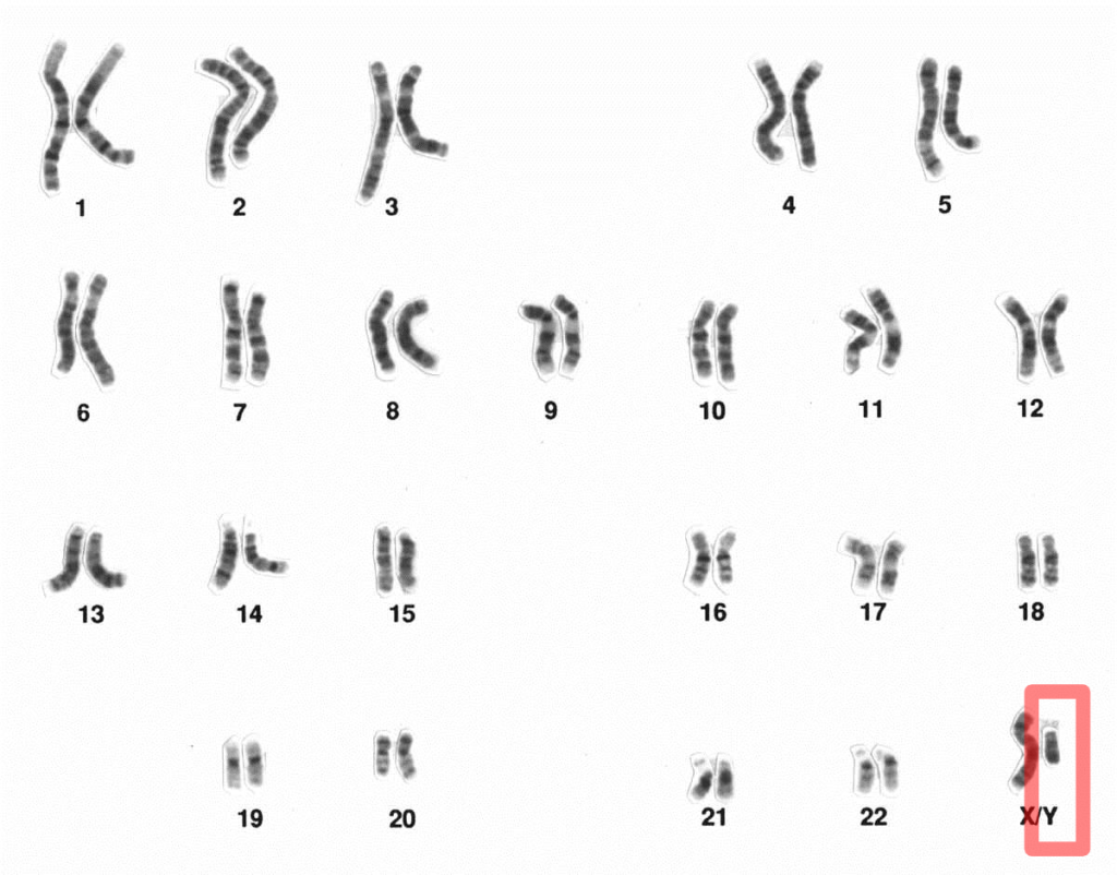 Karyogramm mit markiertem Y-Chromosom