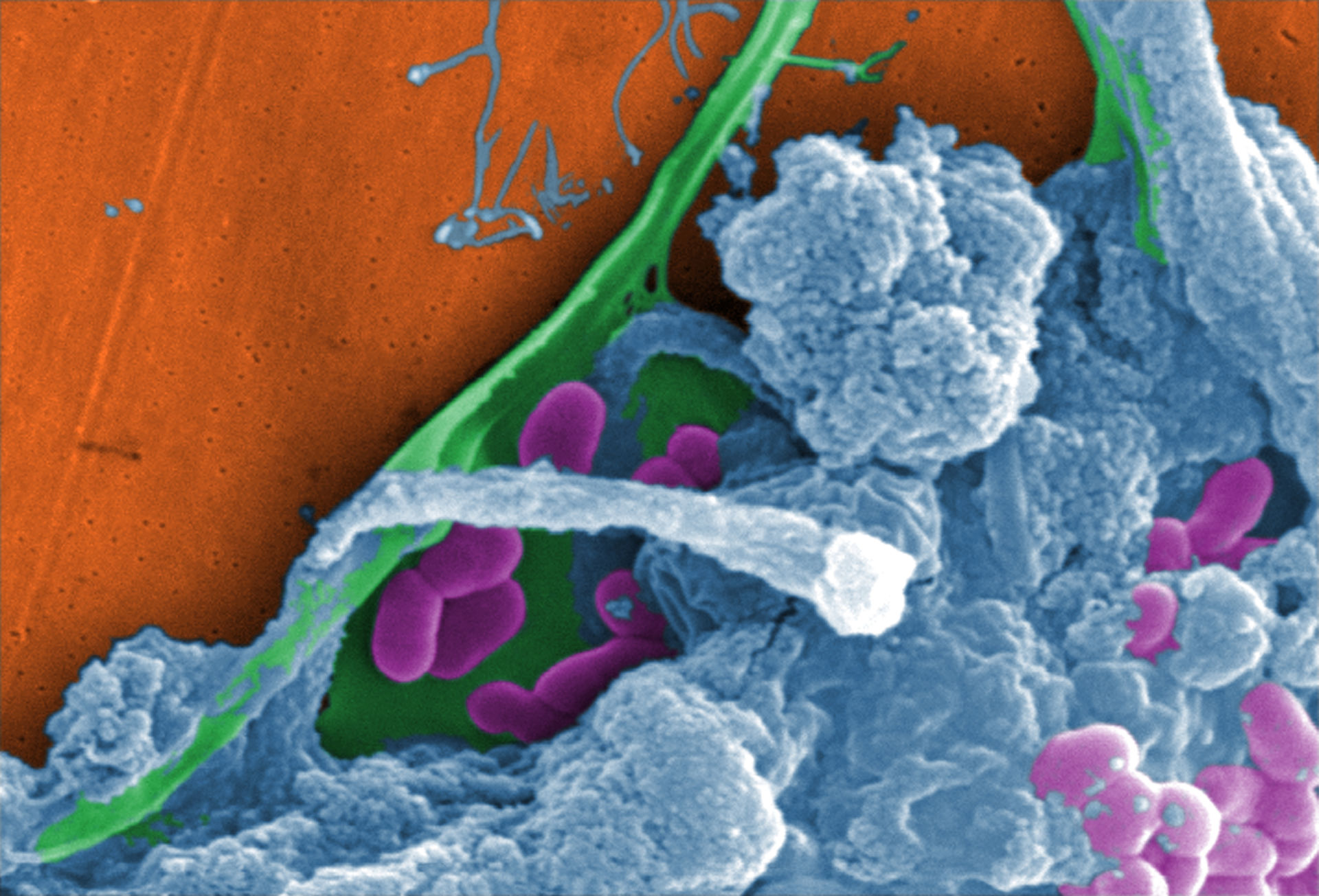 Biofilm mit Amöben und Bakterien (REM-Aufnahme)