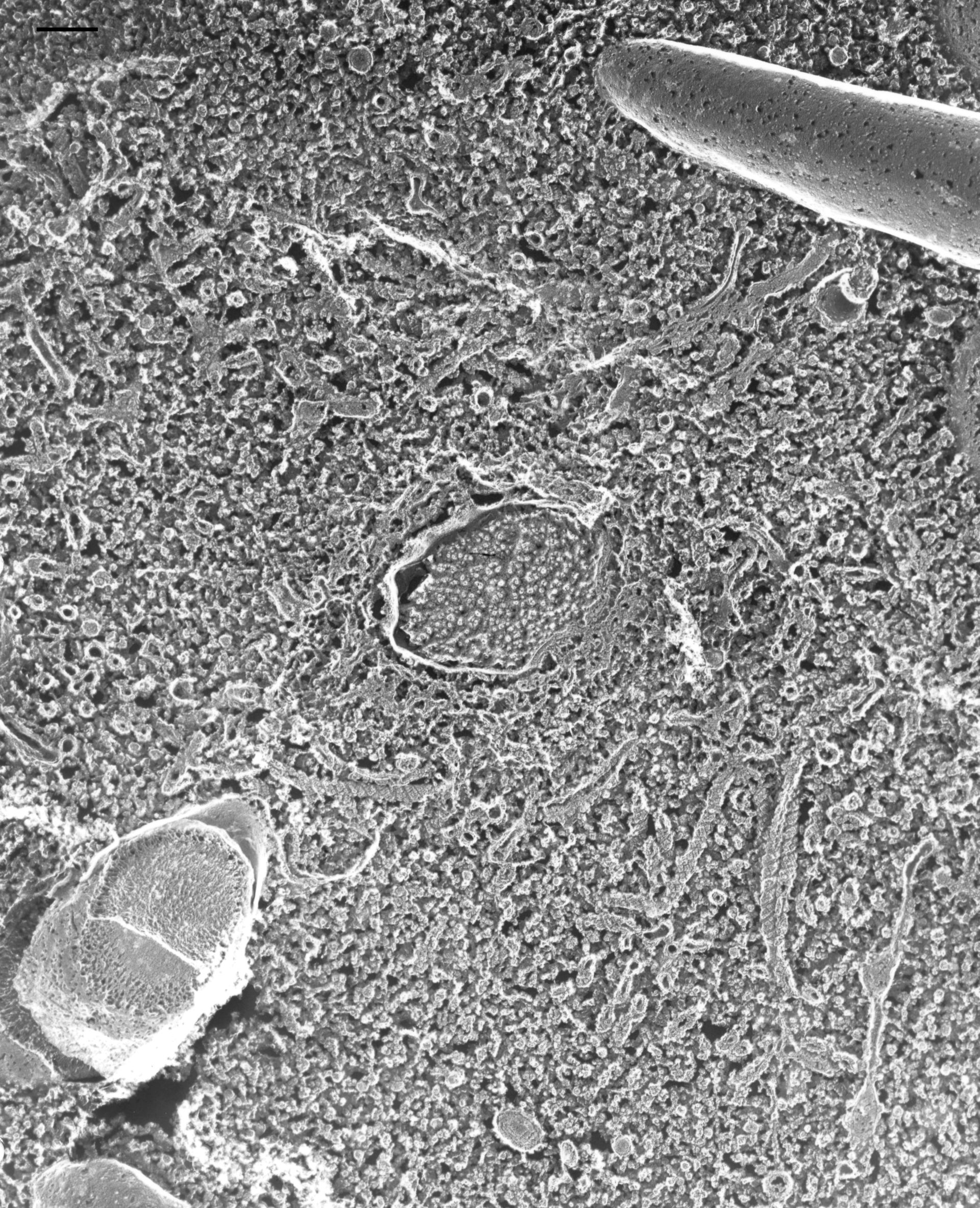 Paramecium multimicronucleatum (Contractile vacuolar membrane) - CIL:21697