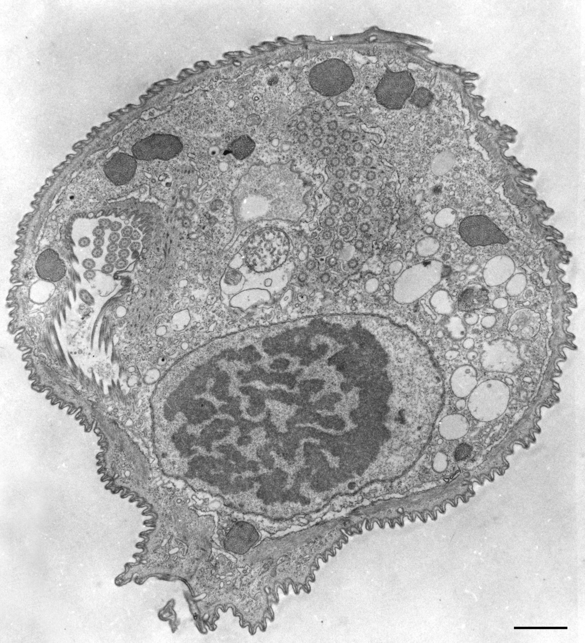 Opercularia coarctata (Cytostome) - CIL:9826