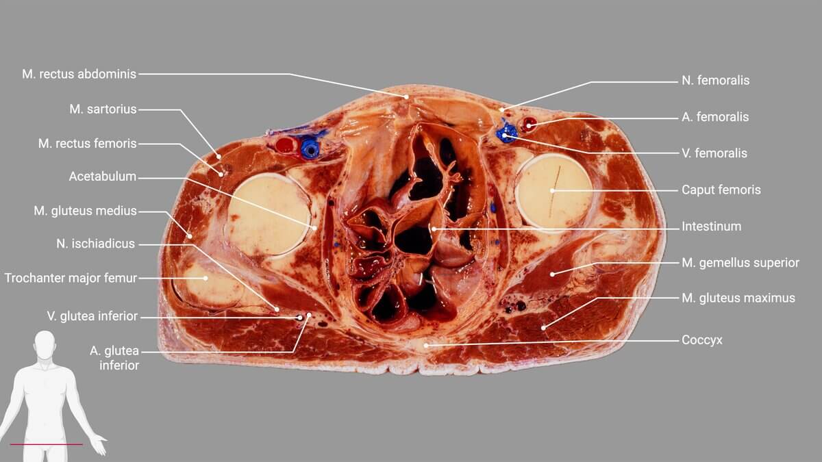 Schnittbildpräparat Abdomen