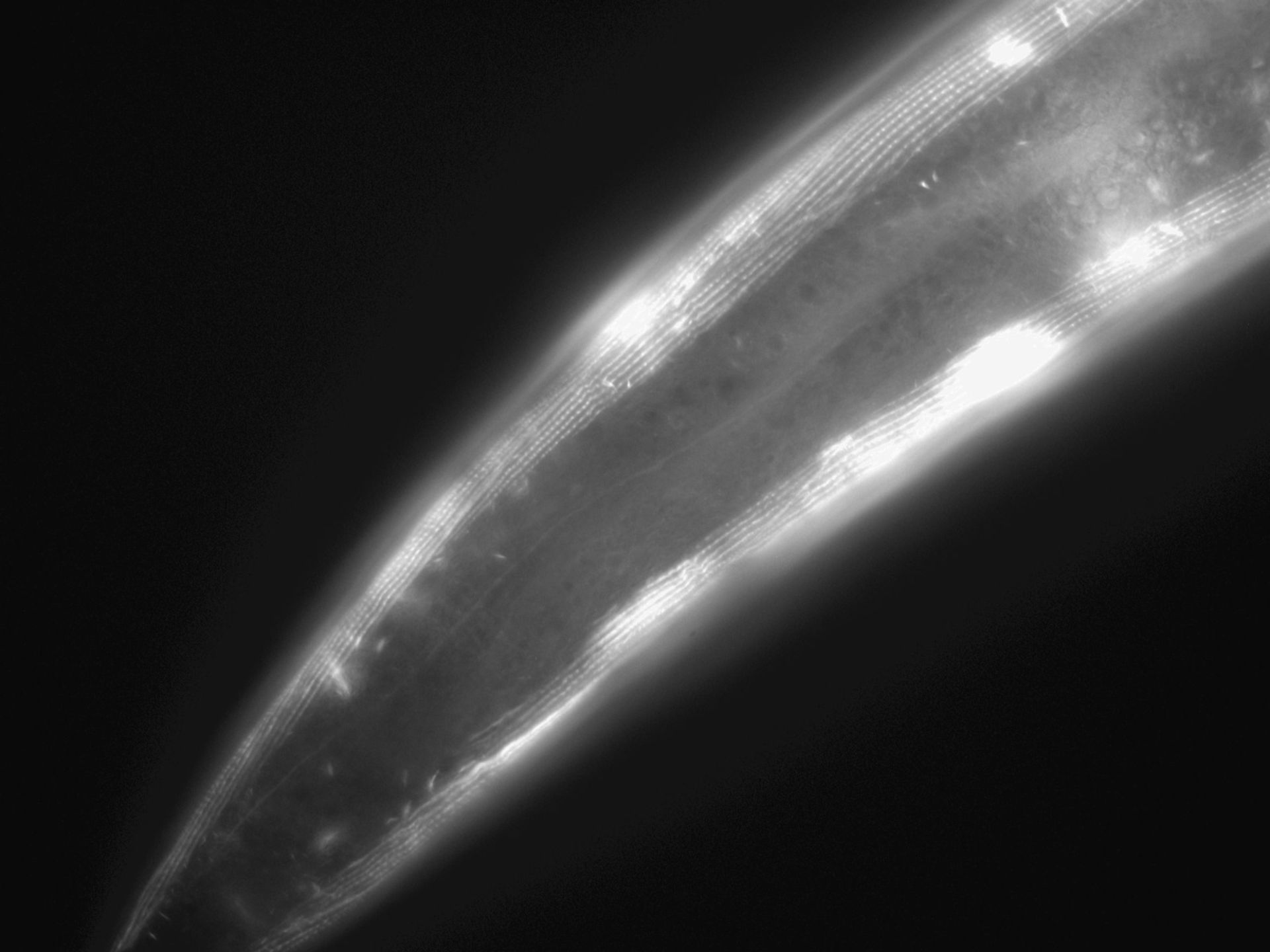 Caenorhabditis elegans (Actin filament) - CIL:1039