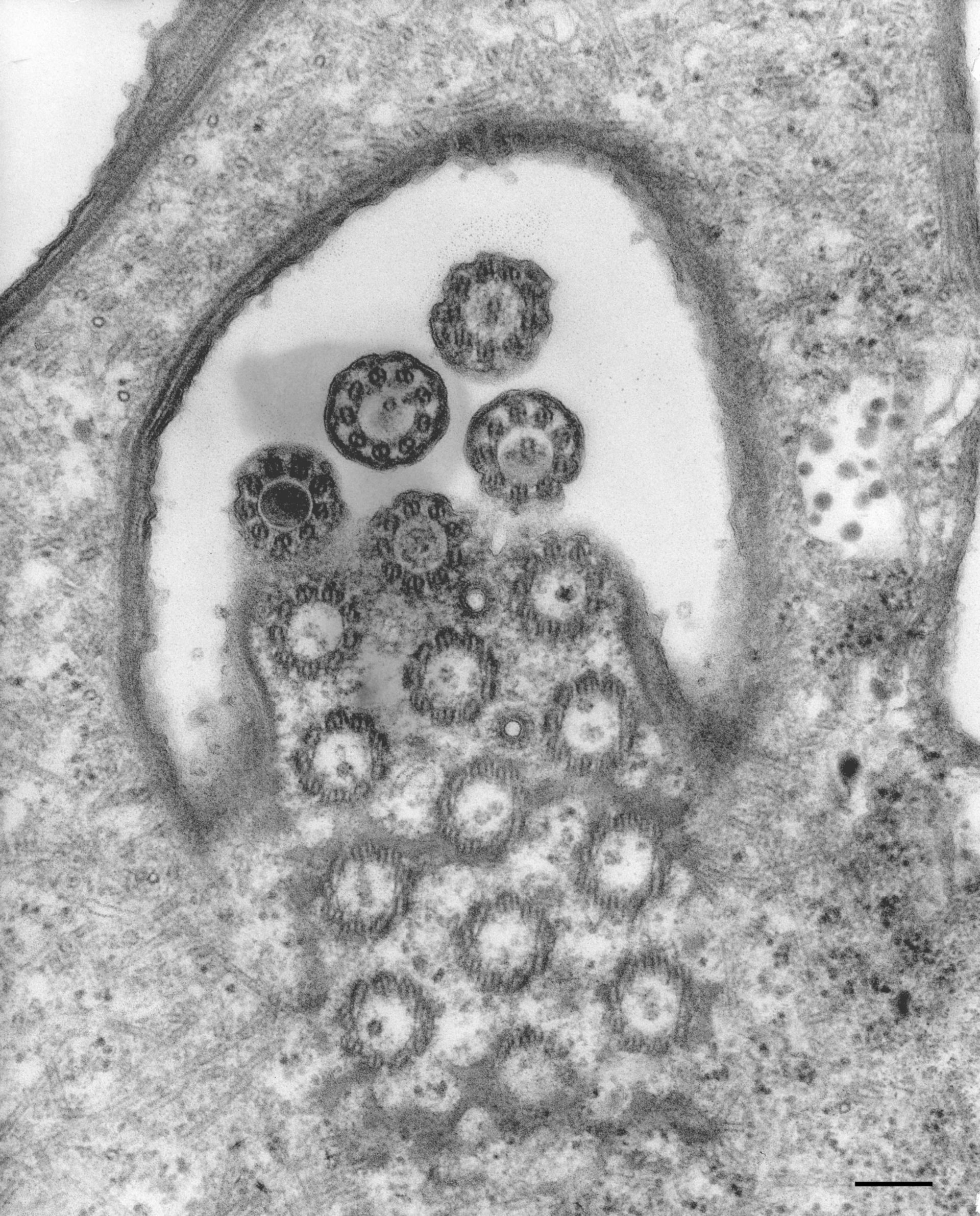 Euplotes sp. (Adoral zone of membranelles) - CIL:9905