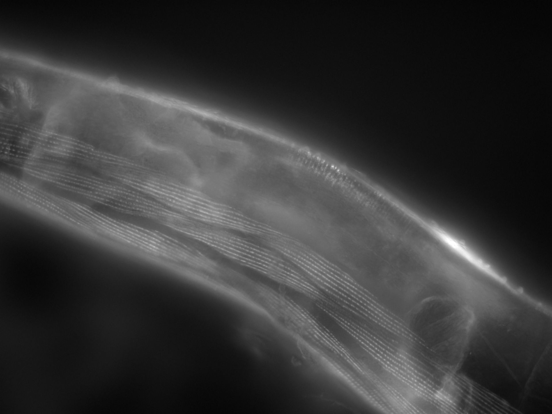 Caenorhabditis elegans (Actin filament) - CIL:1155