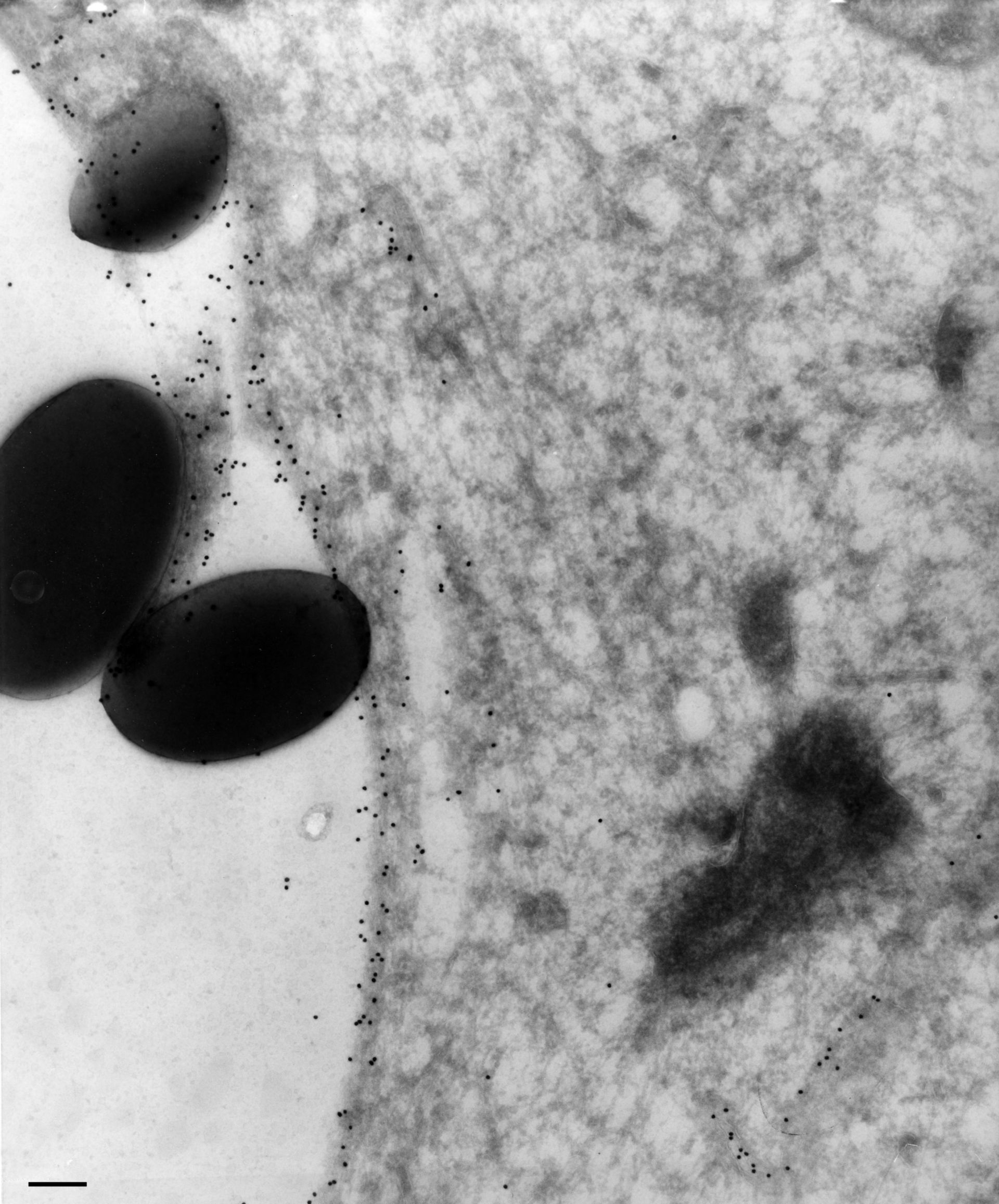 Paramecium multimicronucleatum (Food vacuole) - CIL:36721