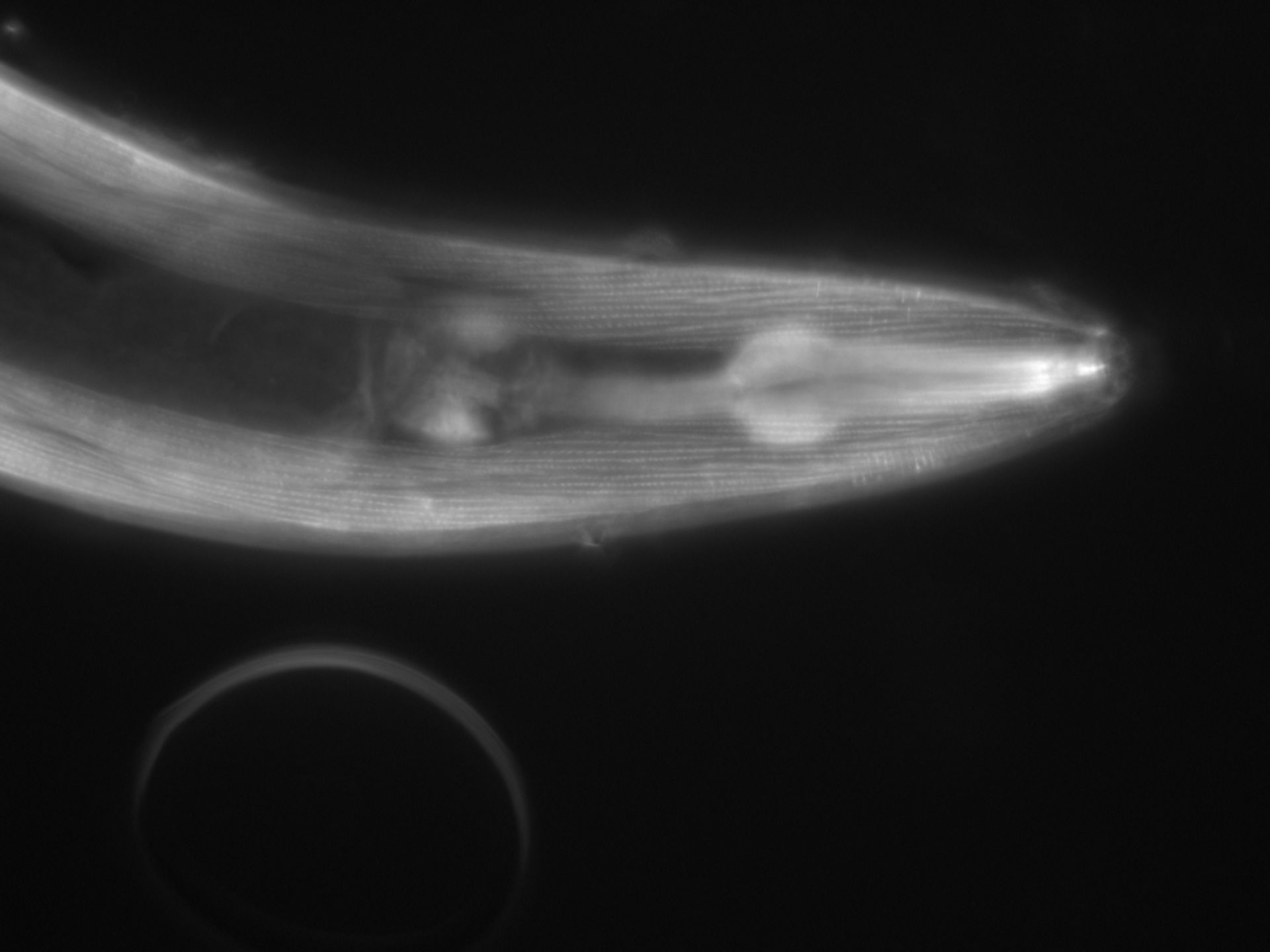 Caenorhabditis elegans (Actin filament) - CIL:1075