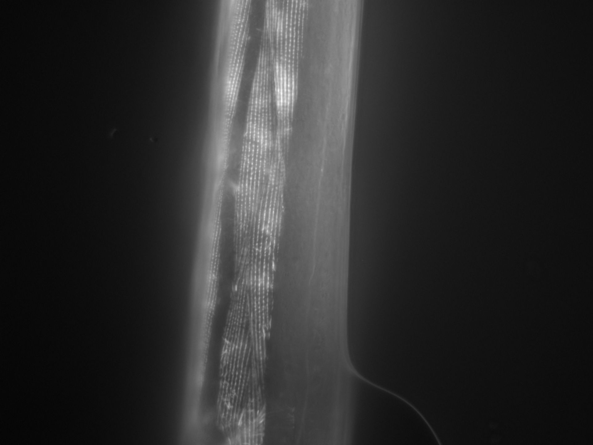 Caenorhabditis elegans (Actin filament) - CIL:1026