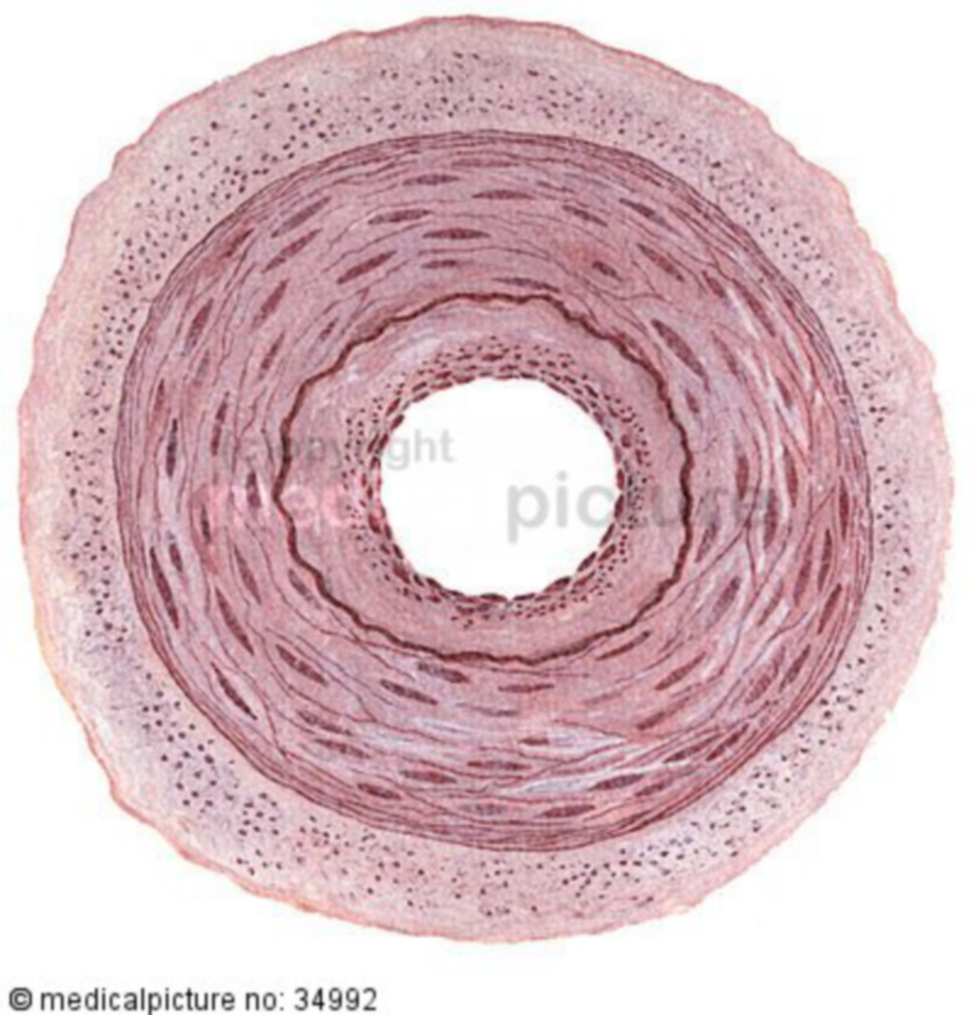  Arterie im Querschnitt 
