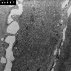 Extrazellularraum DocCheck Flexikon