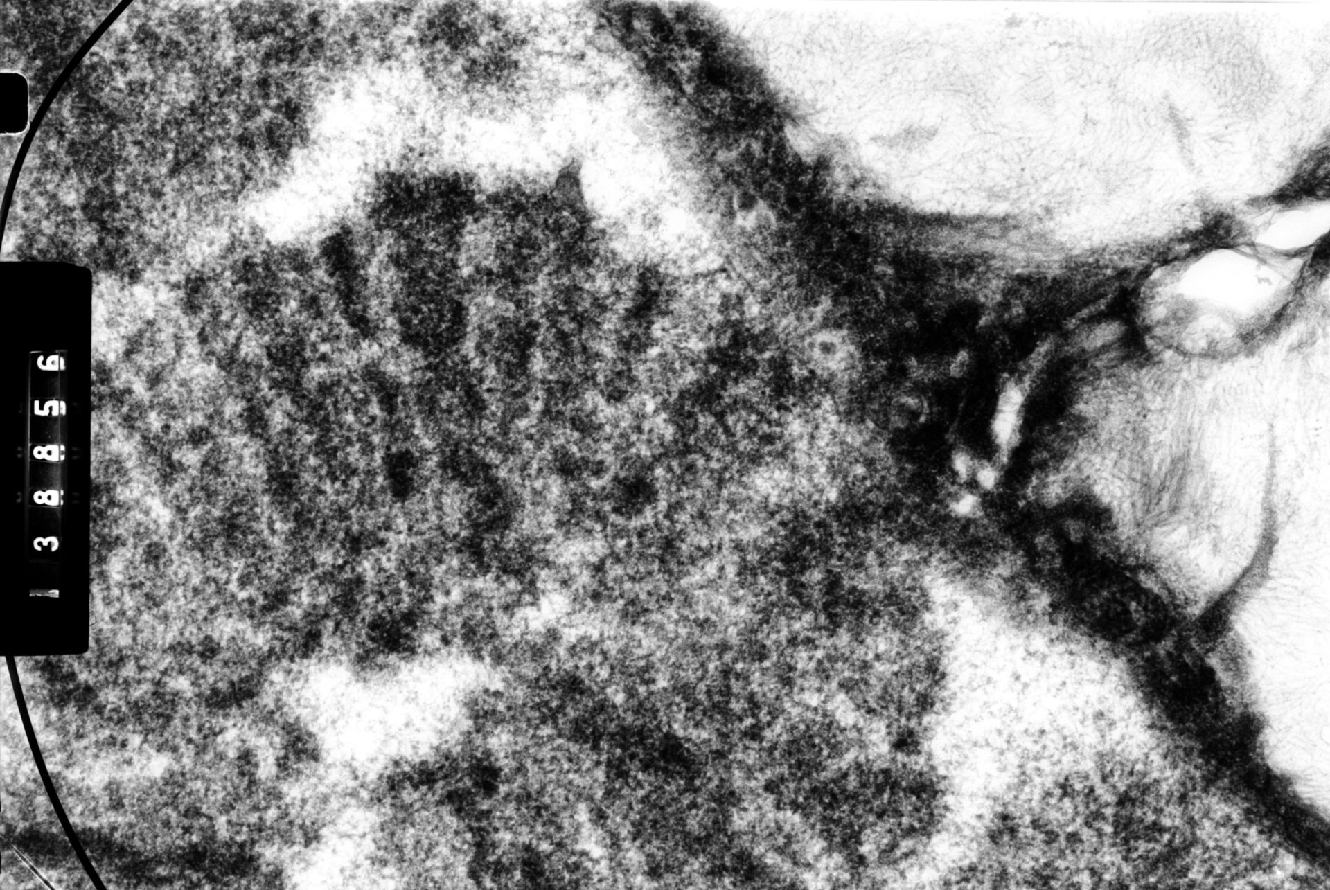 Drosophila melanocephala (Polytene chromosome) - CIL:35445